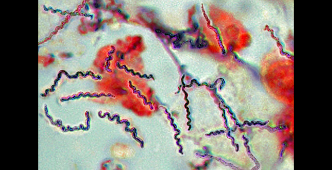 Borrelia Bacteria