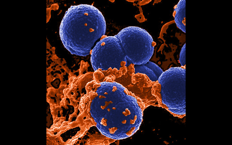 MRSA Bacteria