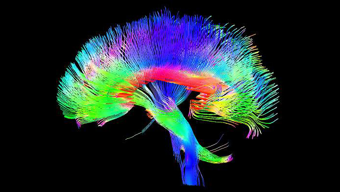 3D scan of Brain Pathways