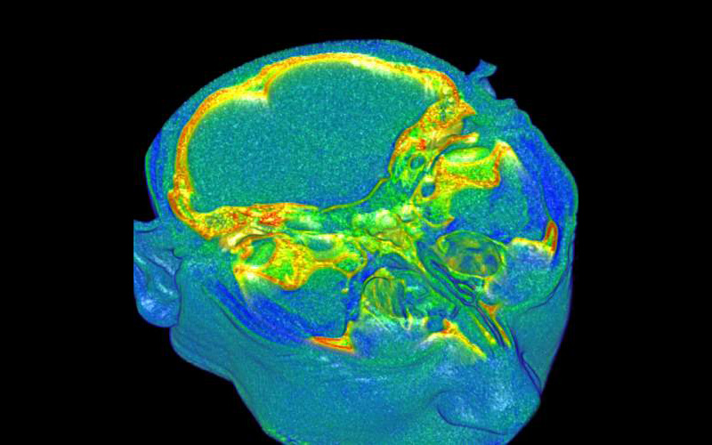 Axial MRI Brain Scan, Medical Scan