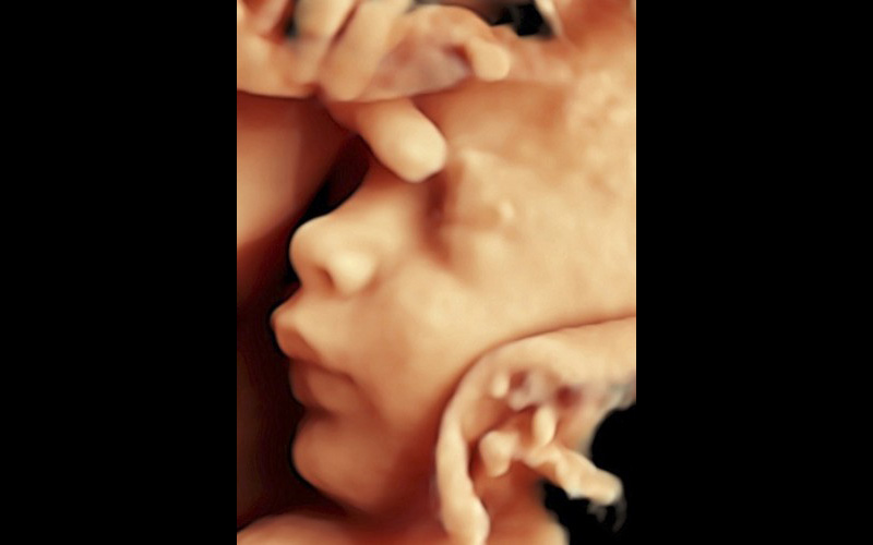 3D Ultrasound of a Baby Fetus in Womb