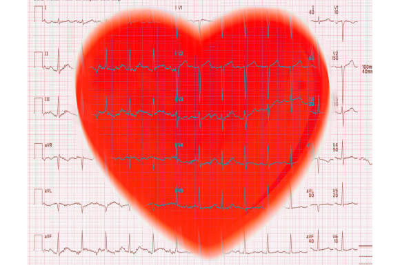 EKG Heart Conceptual