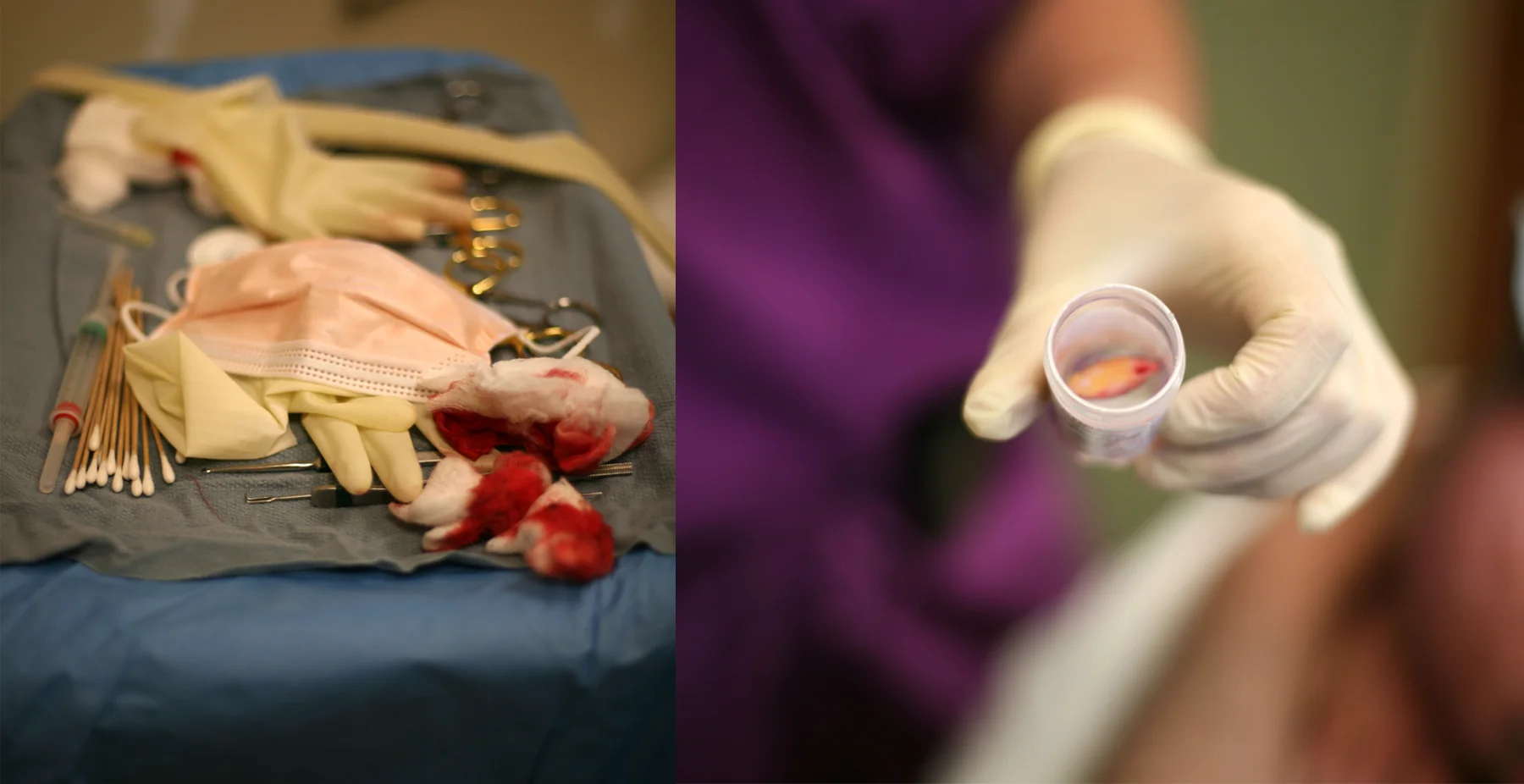 Surgery