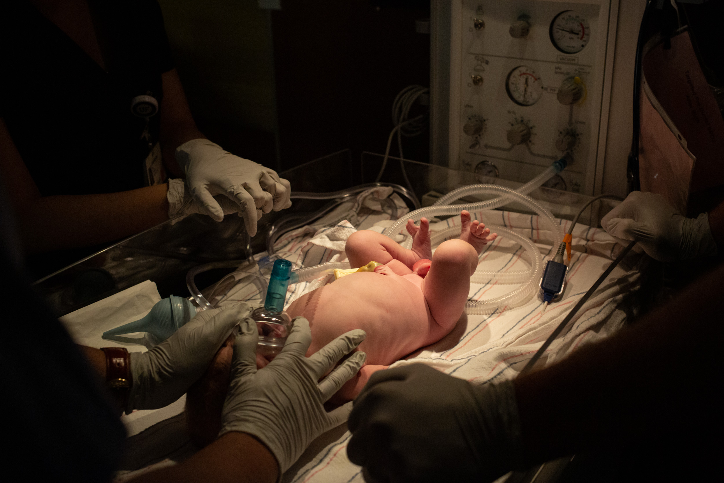 newborn baby boy receiving oxygen