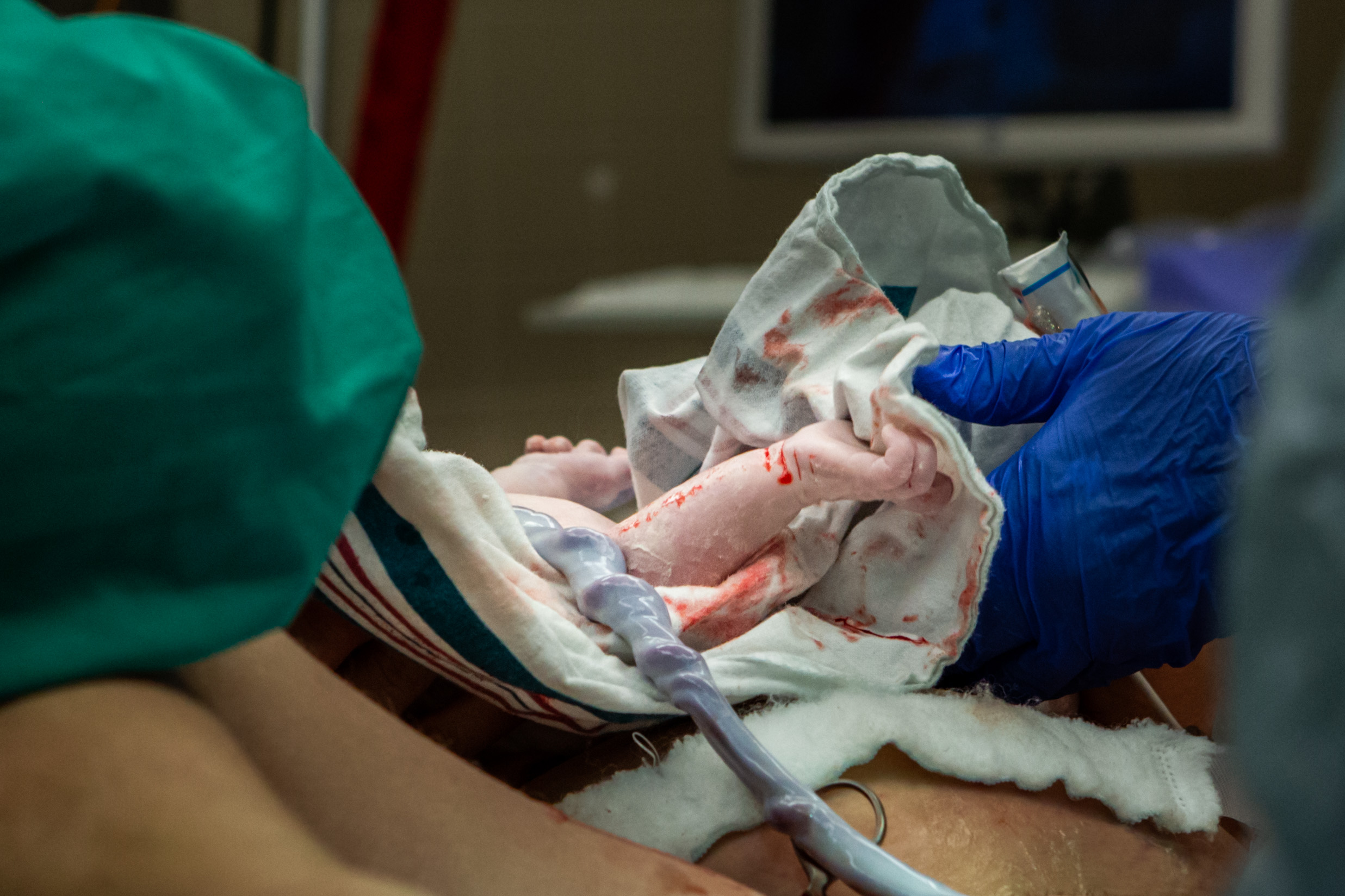 baby's hand and umbilical cord just after birth