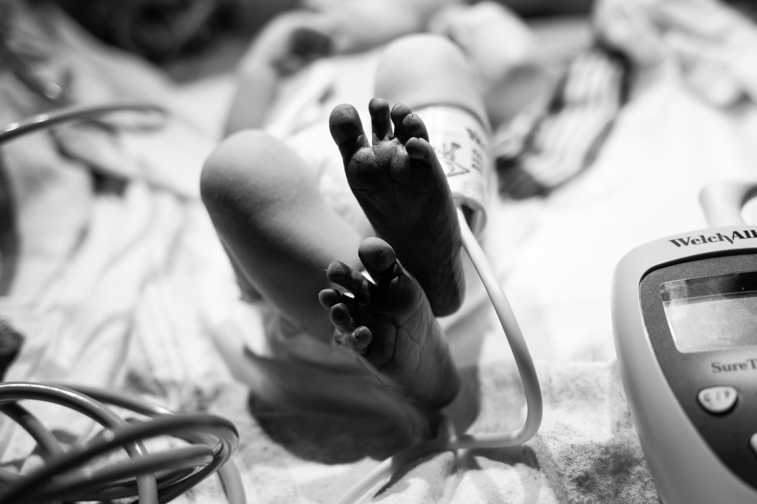 baby feet just after birth