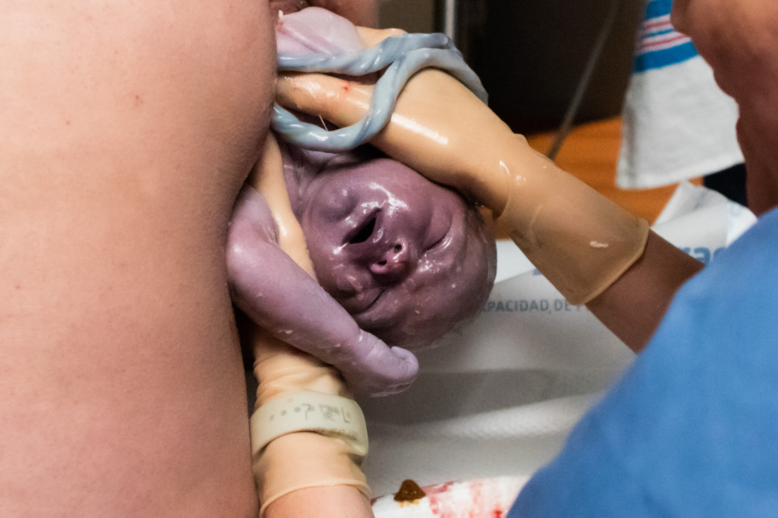 baby being born - unmedicated hospital birth in jacksonville