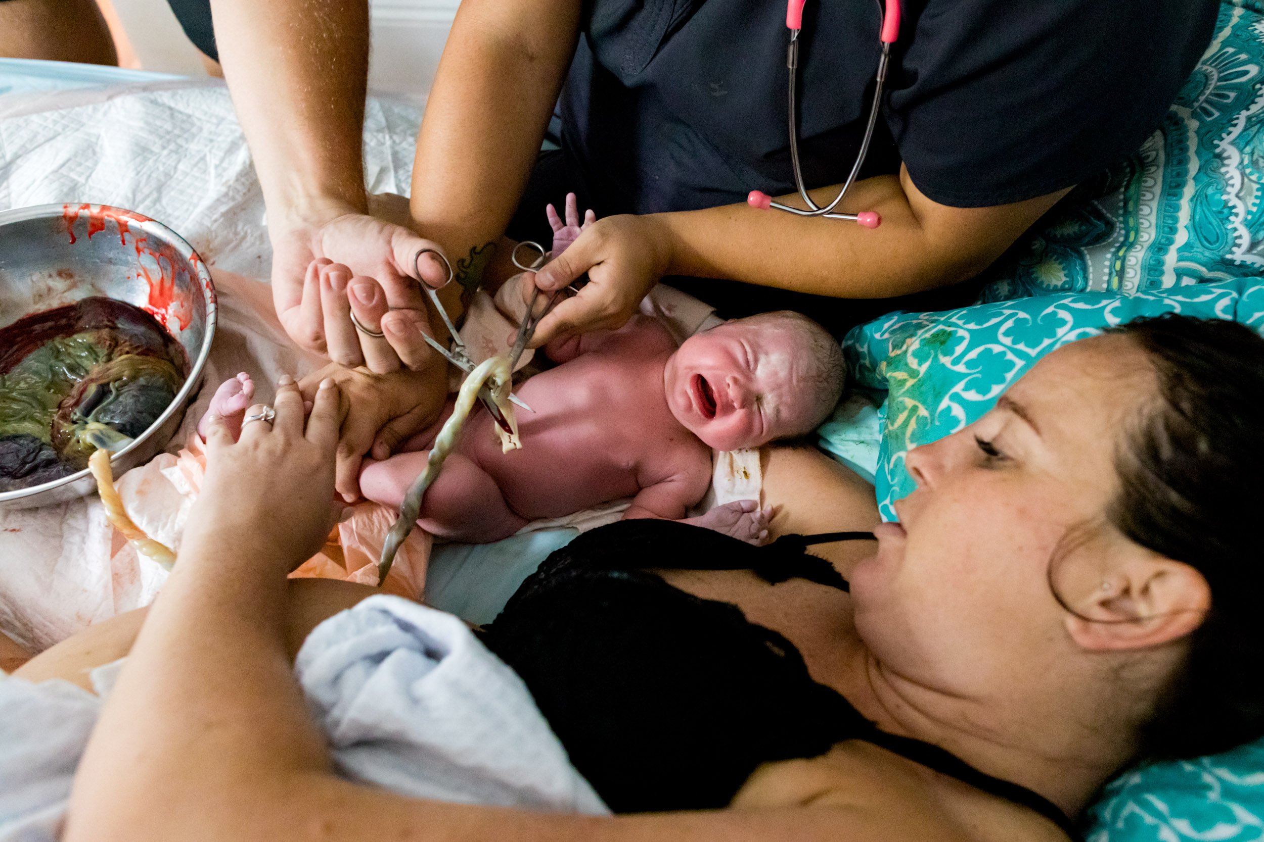 cutting of the umbilical cord
