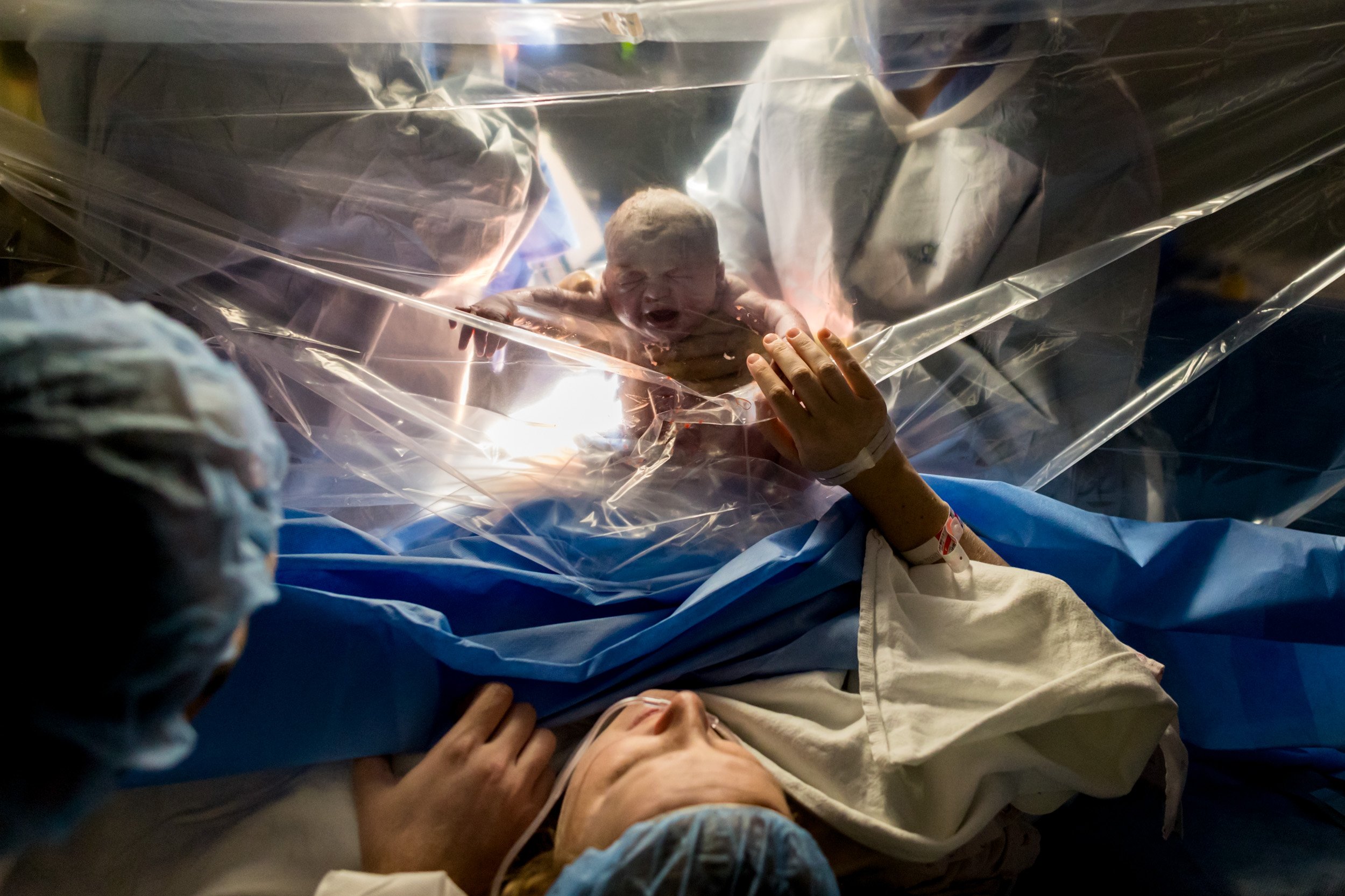 parents looking at their newborn baby through the drape just after the cesarean birth