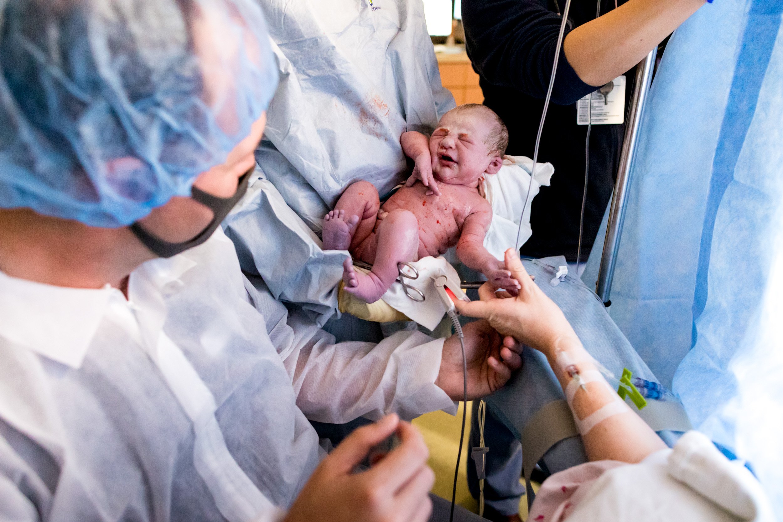 mom and dad touching their baby for the first time after birth by cesarean