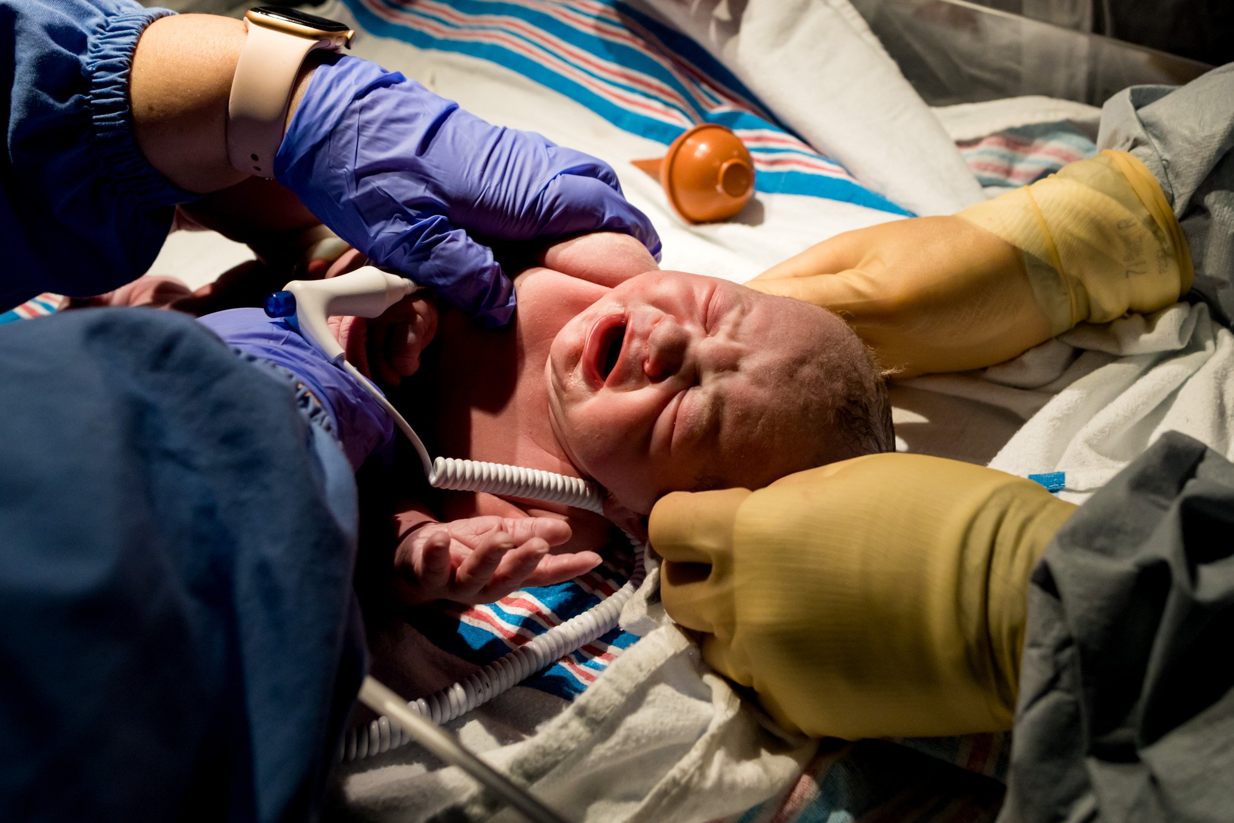 pediatrician examining baby just after birth