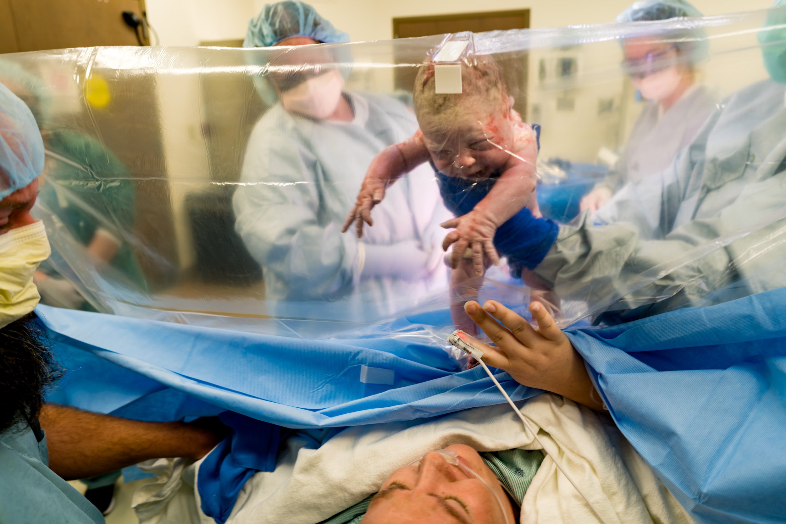 baby being held up to clear drape just after belly birth