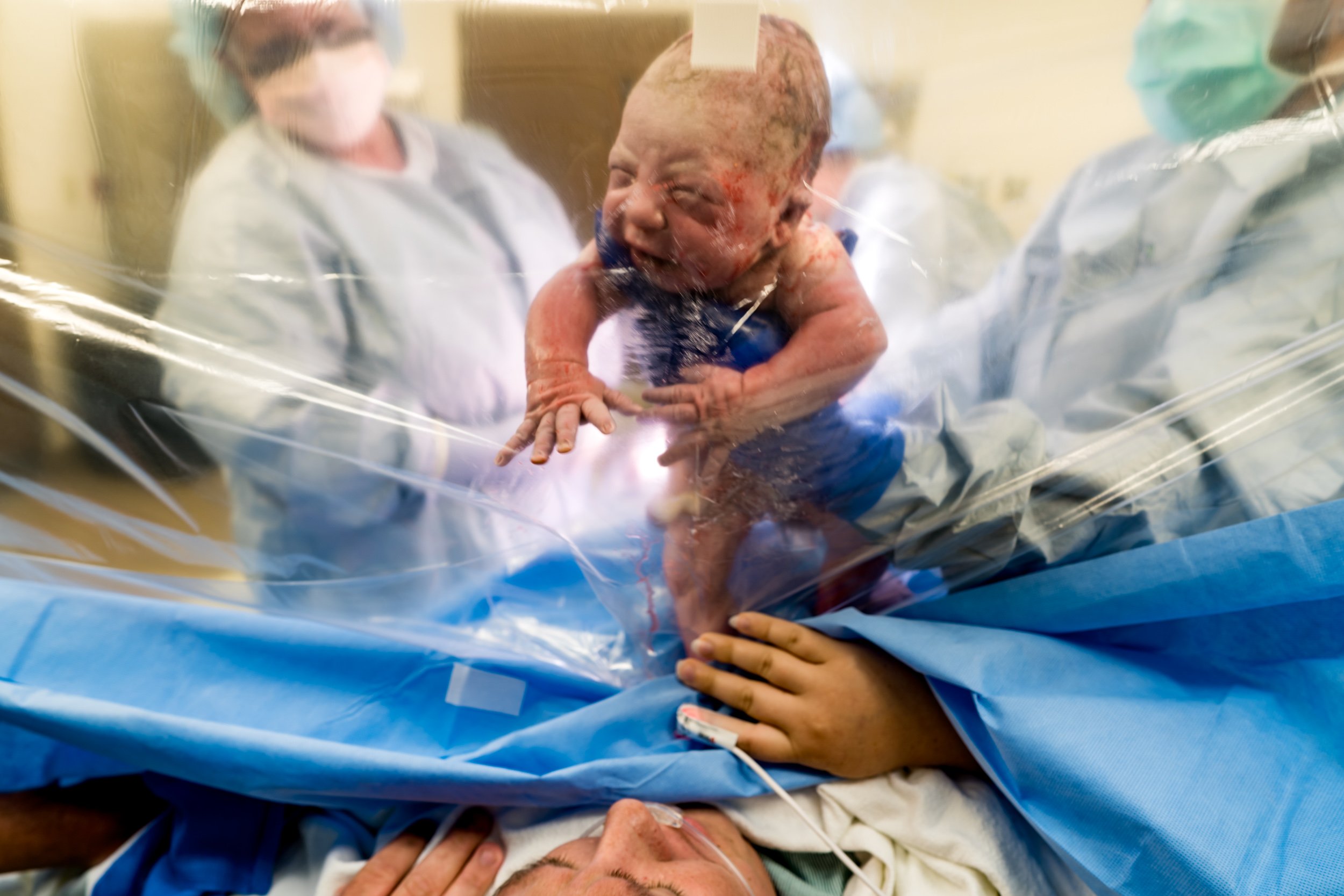 newborn baby being held up to clear drape after cesarean birth