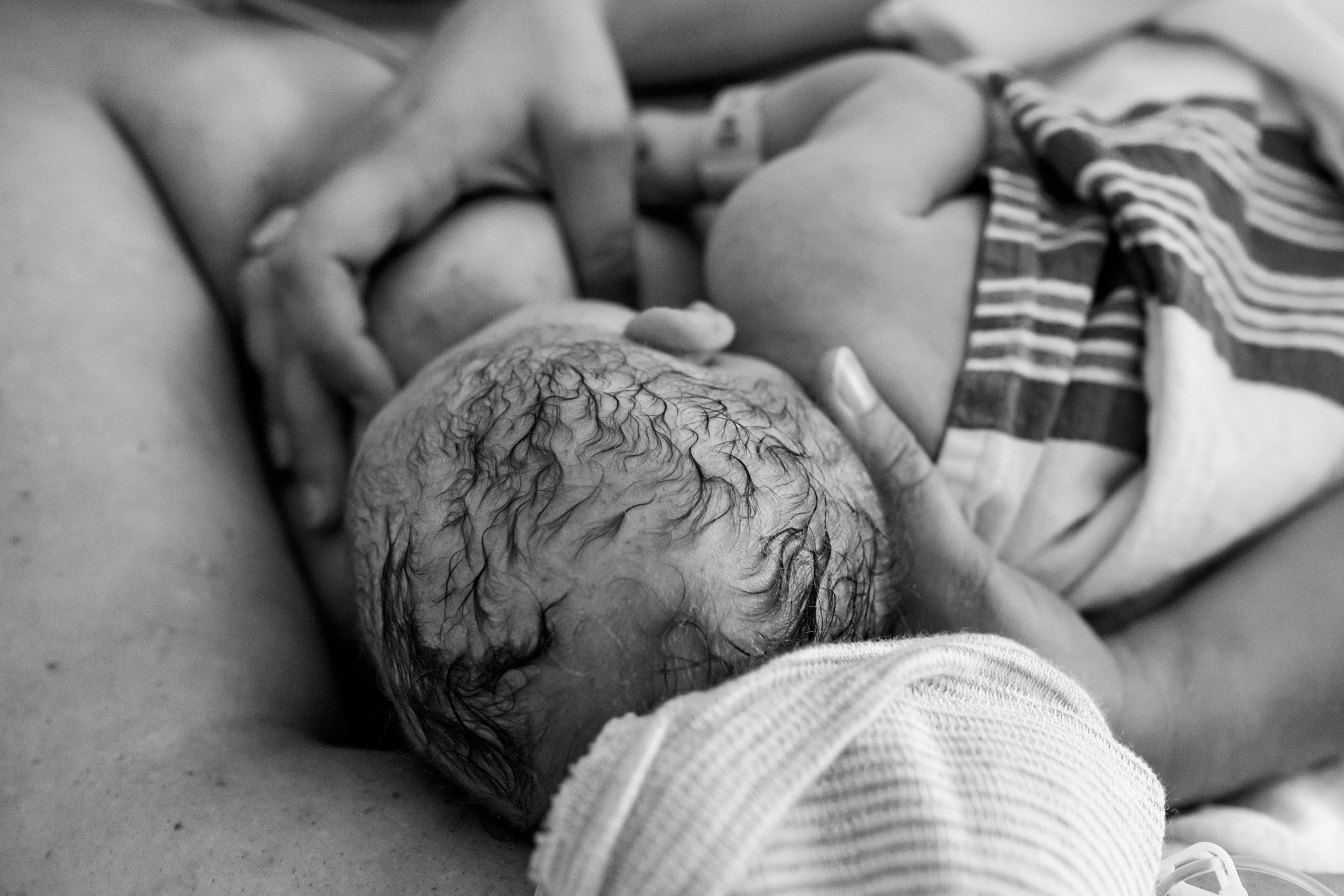 back of newborn baby's head