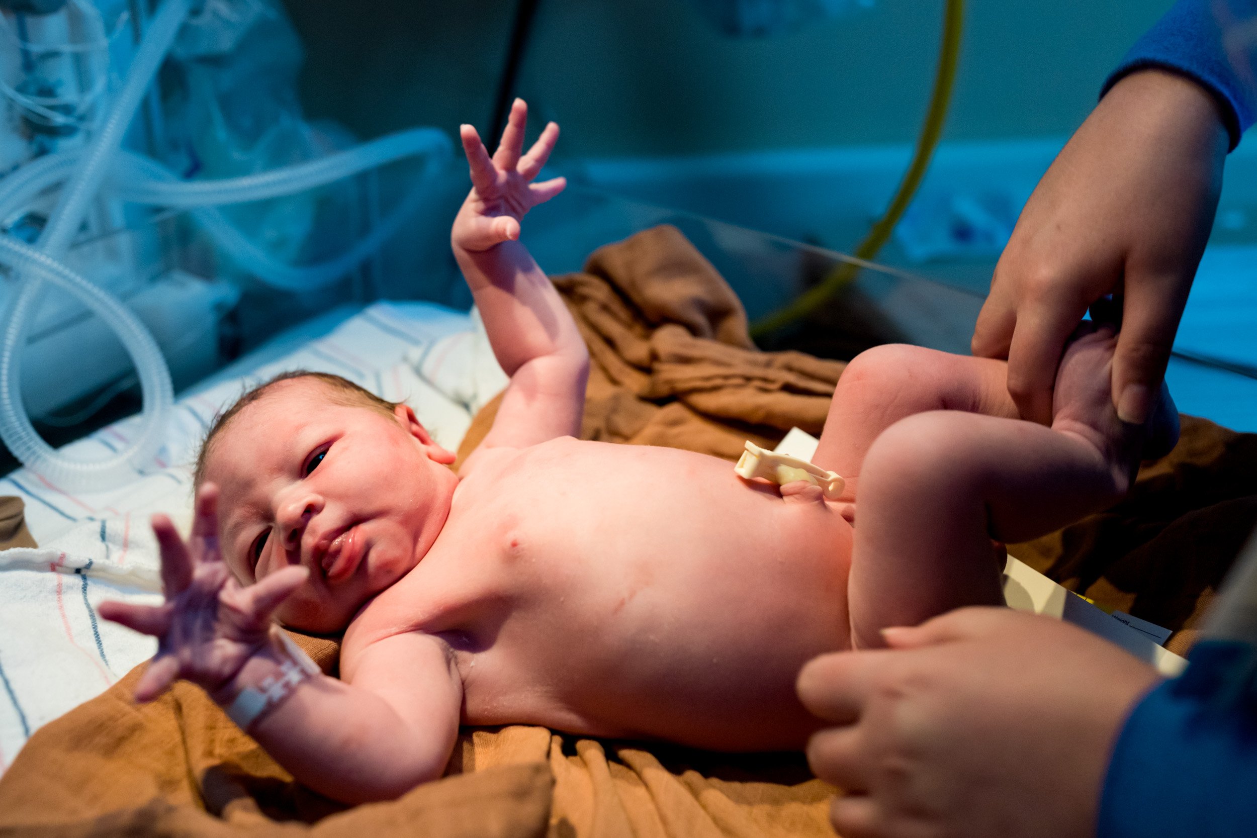 newborn baby with arms stretched out as they are doing the newborn exam