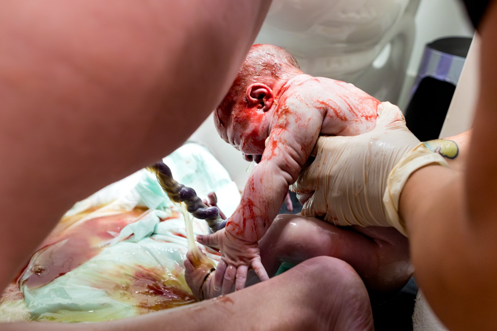 midwife catching baby during birth
