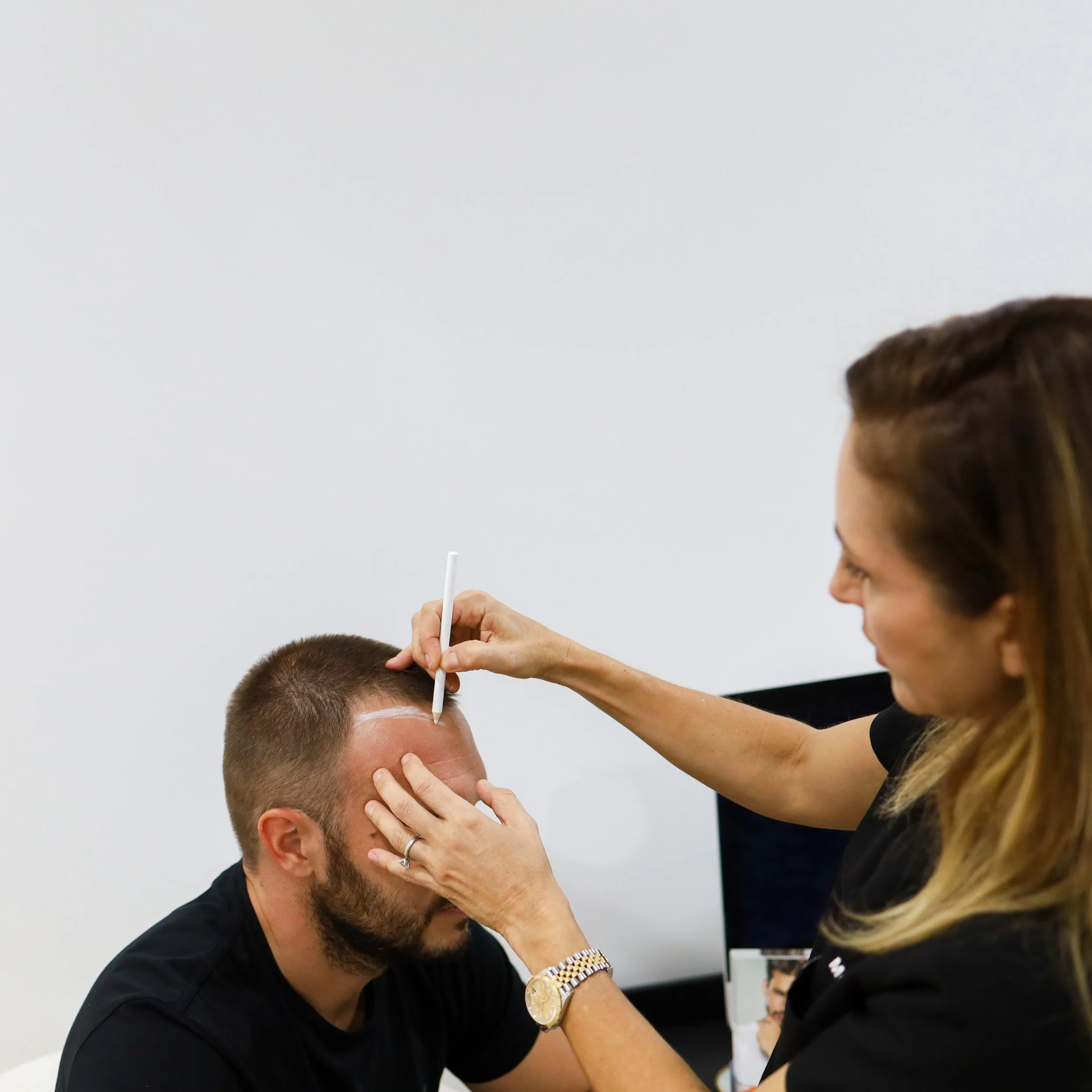 Neograft hair transplant townsville queensland — Northern Skin Studio