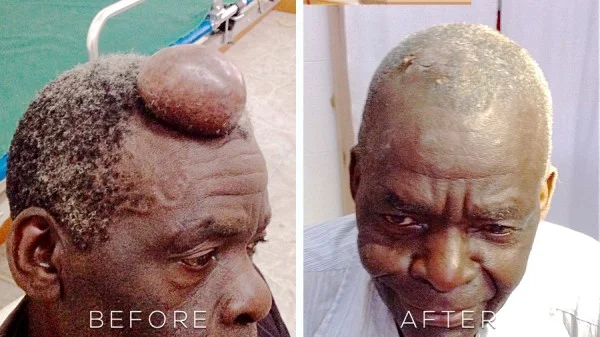 EXTREME-MAKEOVER