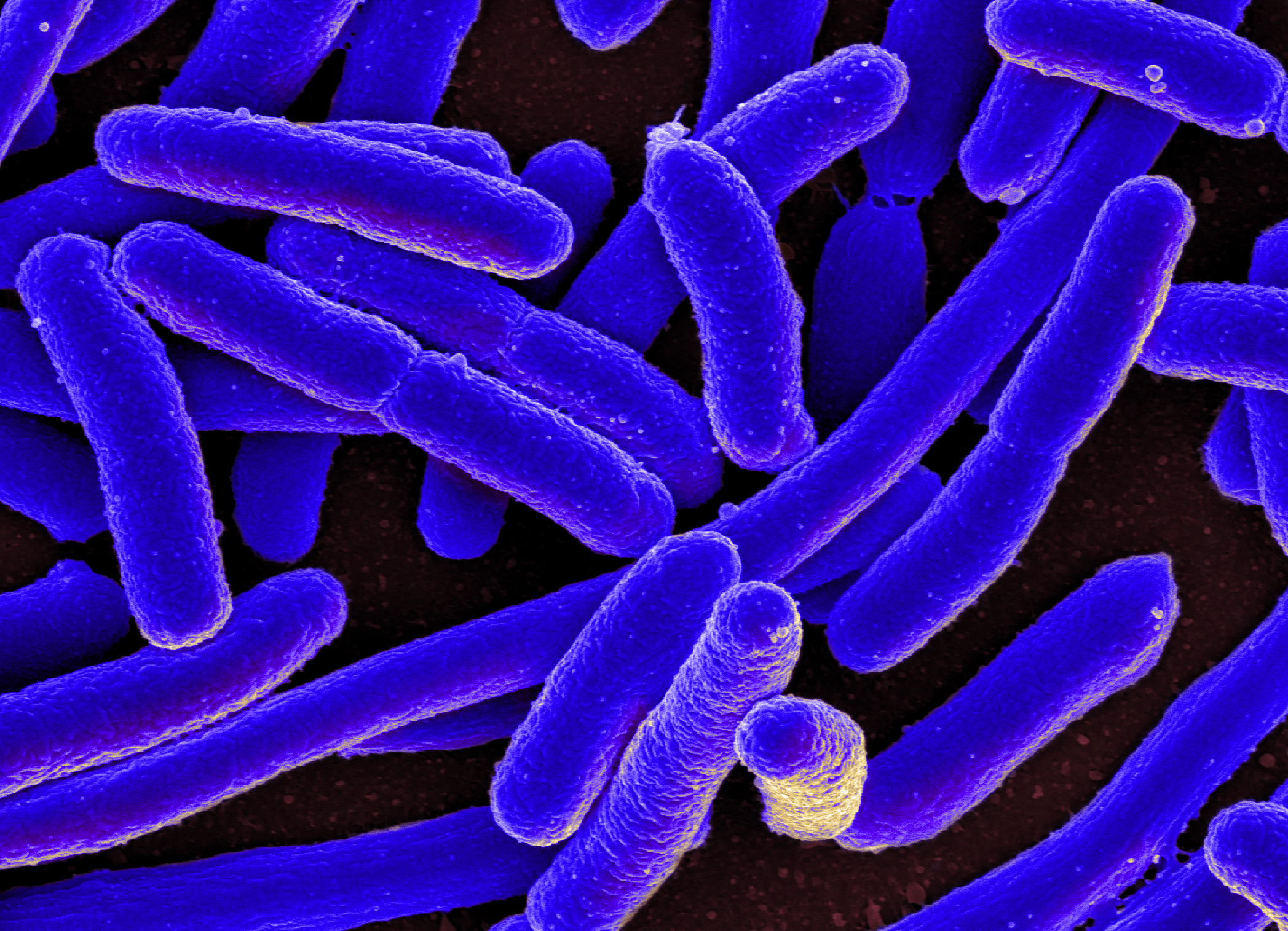 Crispr exploits the immune system machinery of bacteria like E. coli . Source: NIAID/Flickr (CC BY 2.0)
