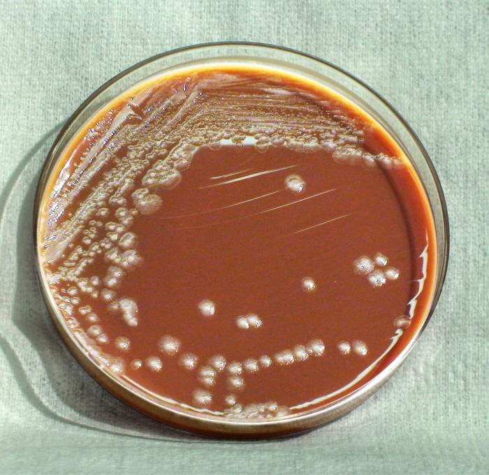 Colonies of Yersinia pestis , grown on chocolate agar. Yum. US Department of Health and Human Services/Wikimedia Commons (public domain)