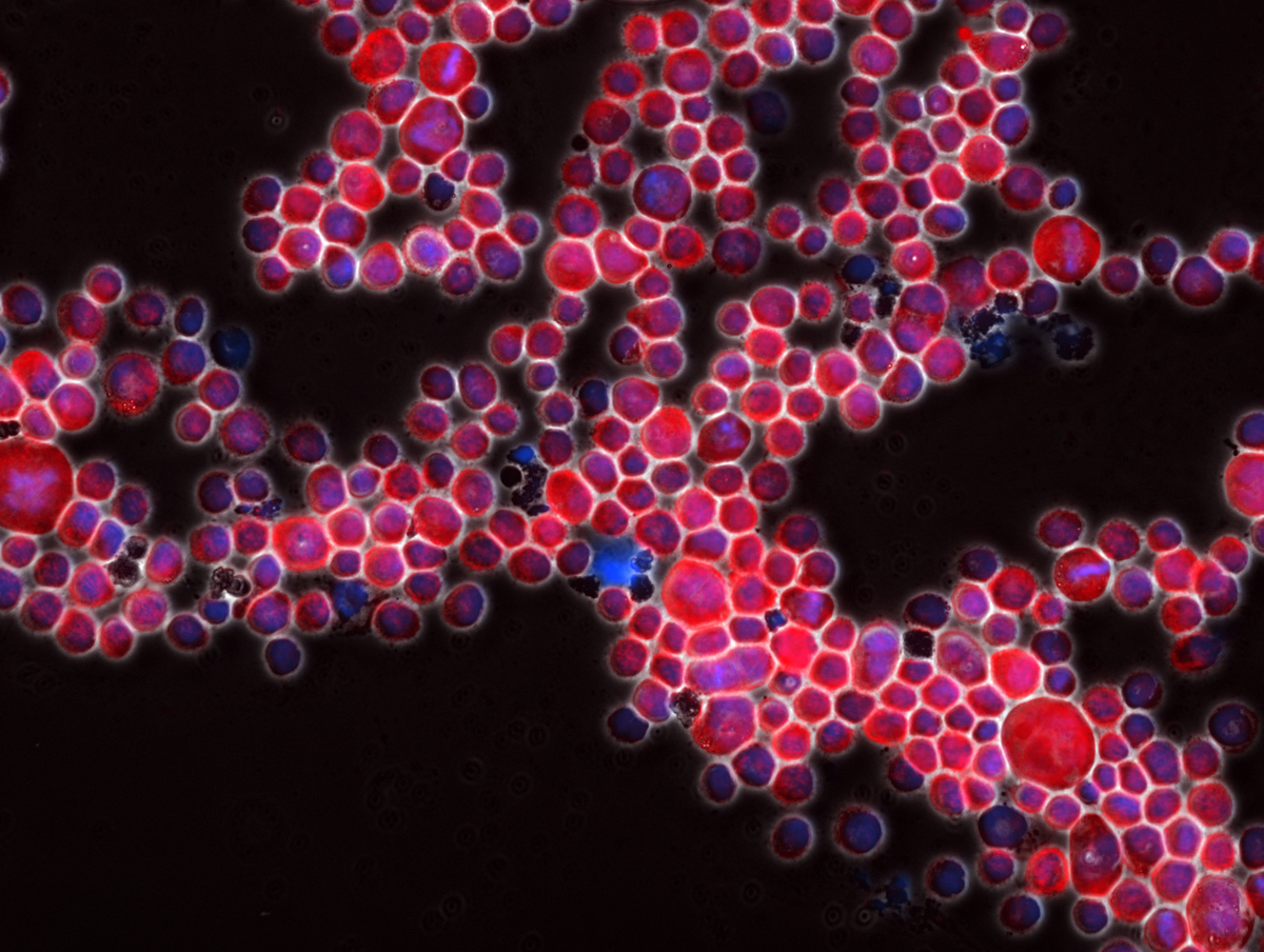 It can be difficult to associate research samples, such as these HeLa cells, with the real person who donated them. Euan Slorach/Flickr (CC BY-NC-ND 2.0)