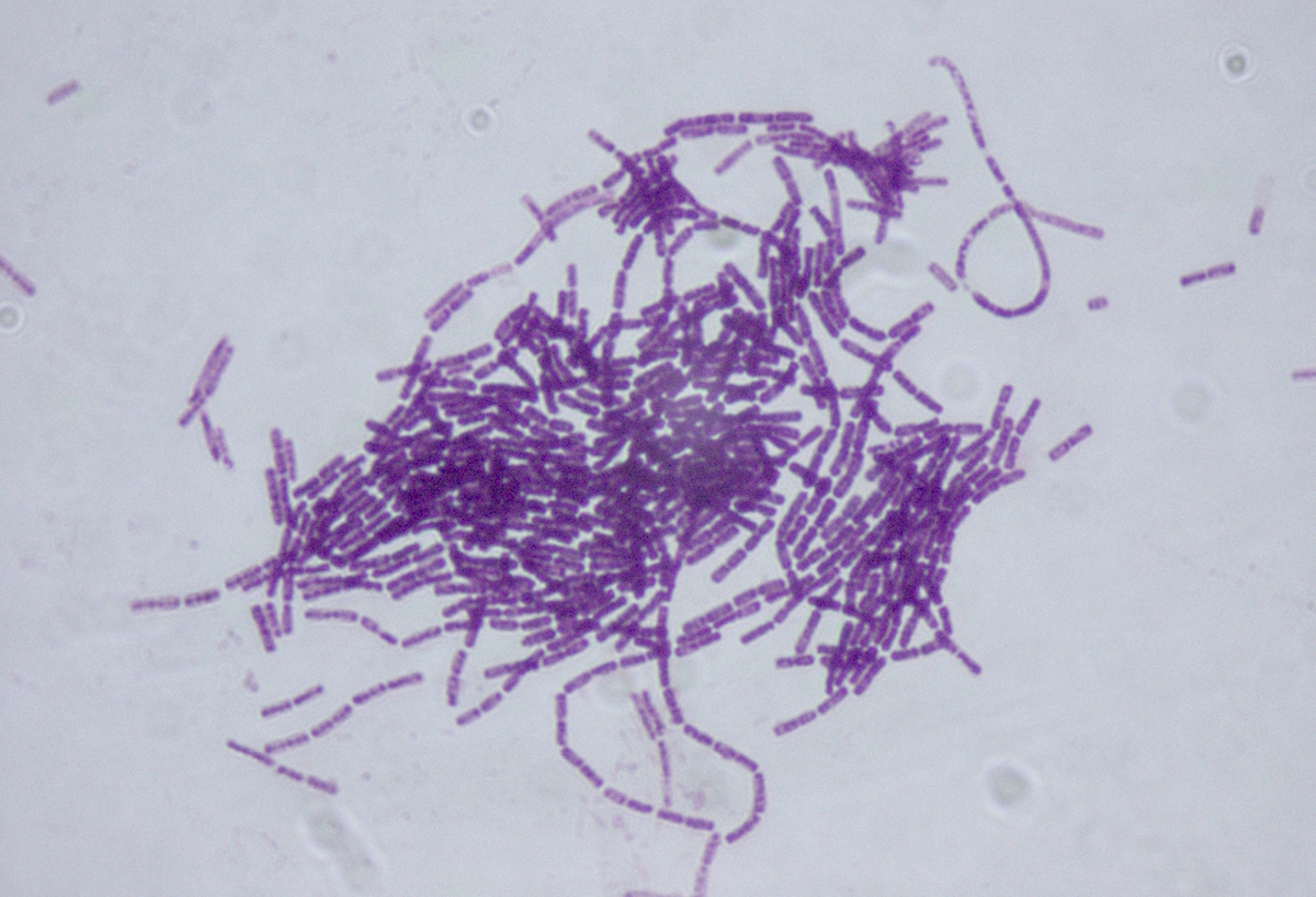 A cluster of rod-shaped Bacillus thuringiensis bacteria under the microscope, removed from their usual habitat in the soil. Dr. Sahay/Wikimedia Commons (CC BY-SA 3.0)