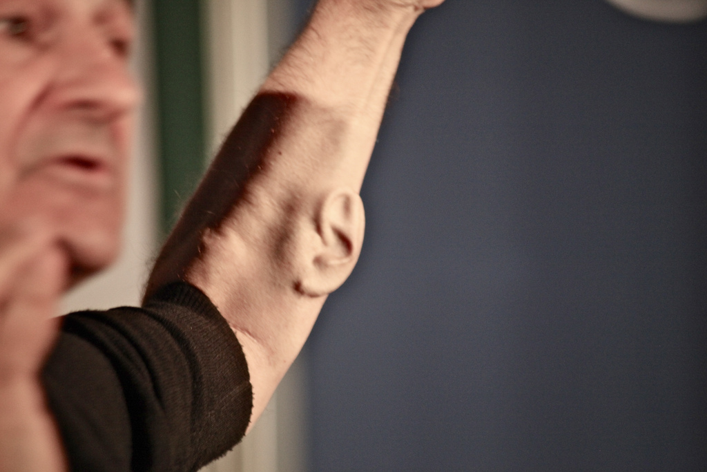 Stelarc and his third ‘ear’. The next stage of his project is to have a microphone inserted and connected to the internet. Anyone with internet access will be able to listen in to the ear, in real time. Andy Miah/Flickr (CC BY-SA 2.0)