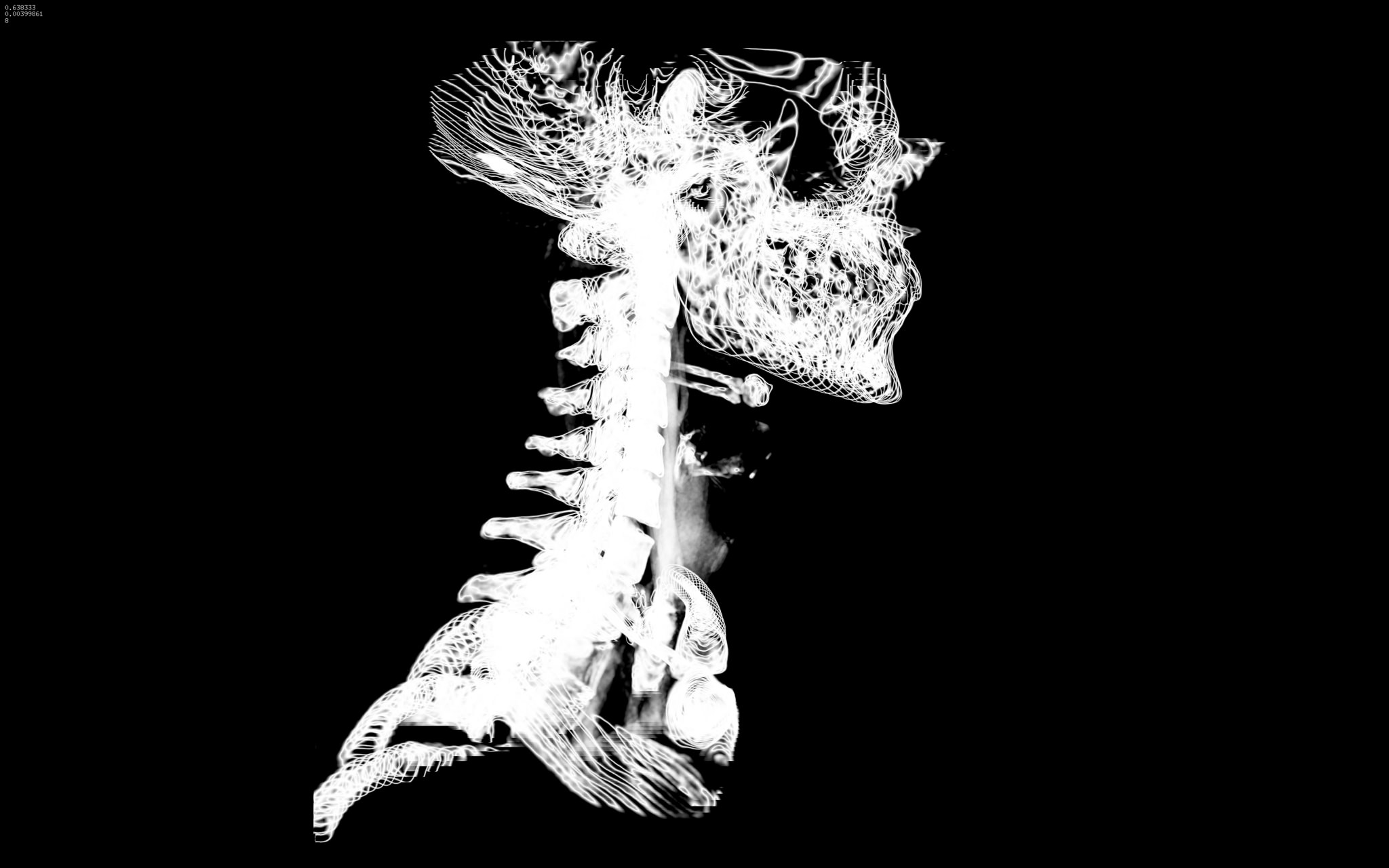 Deep learning has the power to revolutionise the medical industry. Huge sets of images, such as CT scans, can be compared to currently existing lab research. Kyle McDonald/Flickr (CC BY 2.0)