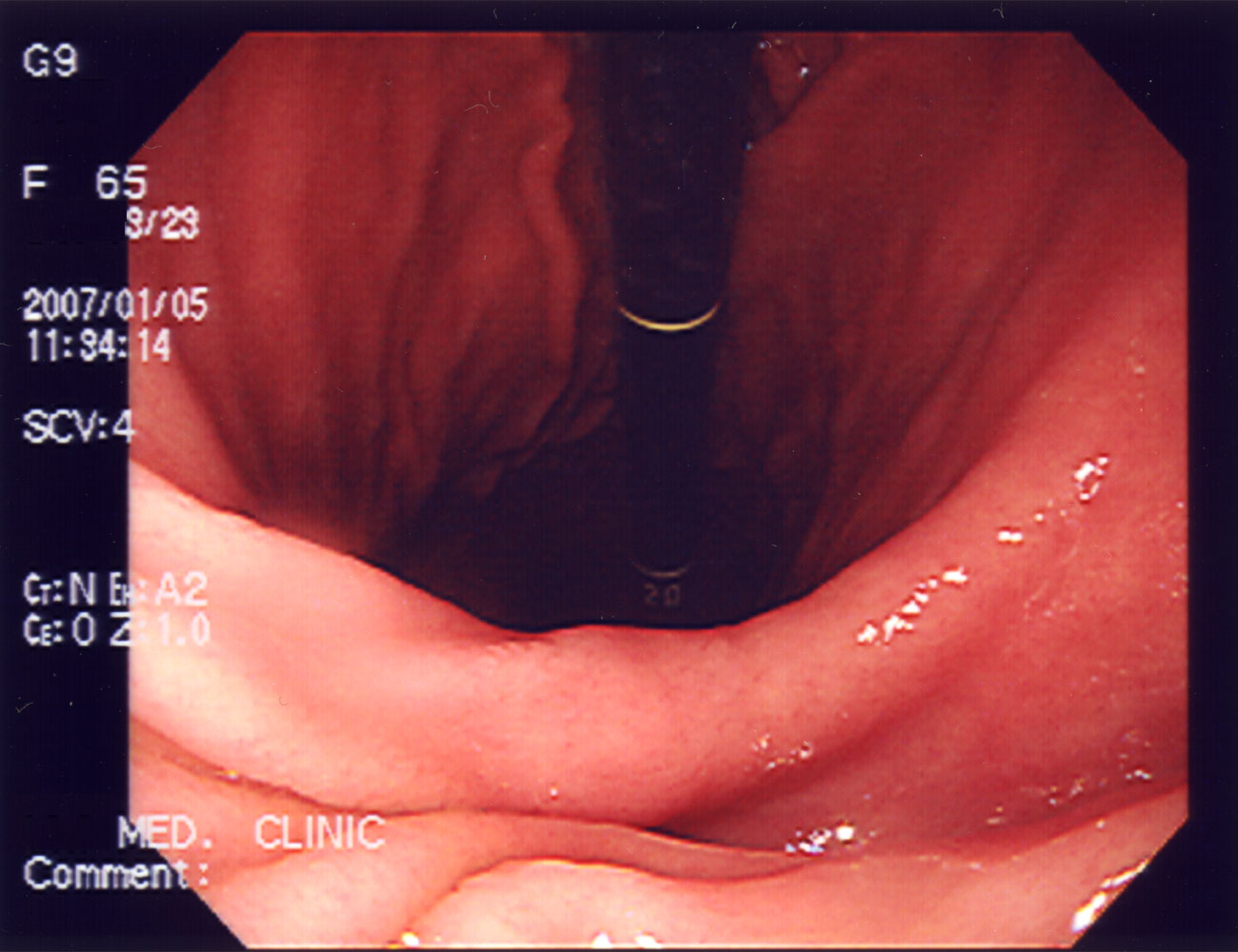 Almost every corner of our bodies, including the gastrointestinal tract, is teaming with microorganisms. Ignis/Wikimedia Commons (CC BY-SA 3.0)