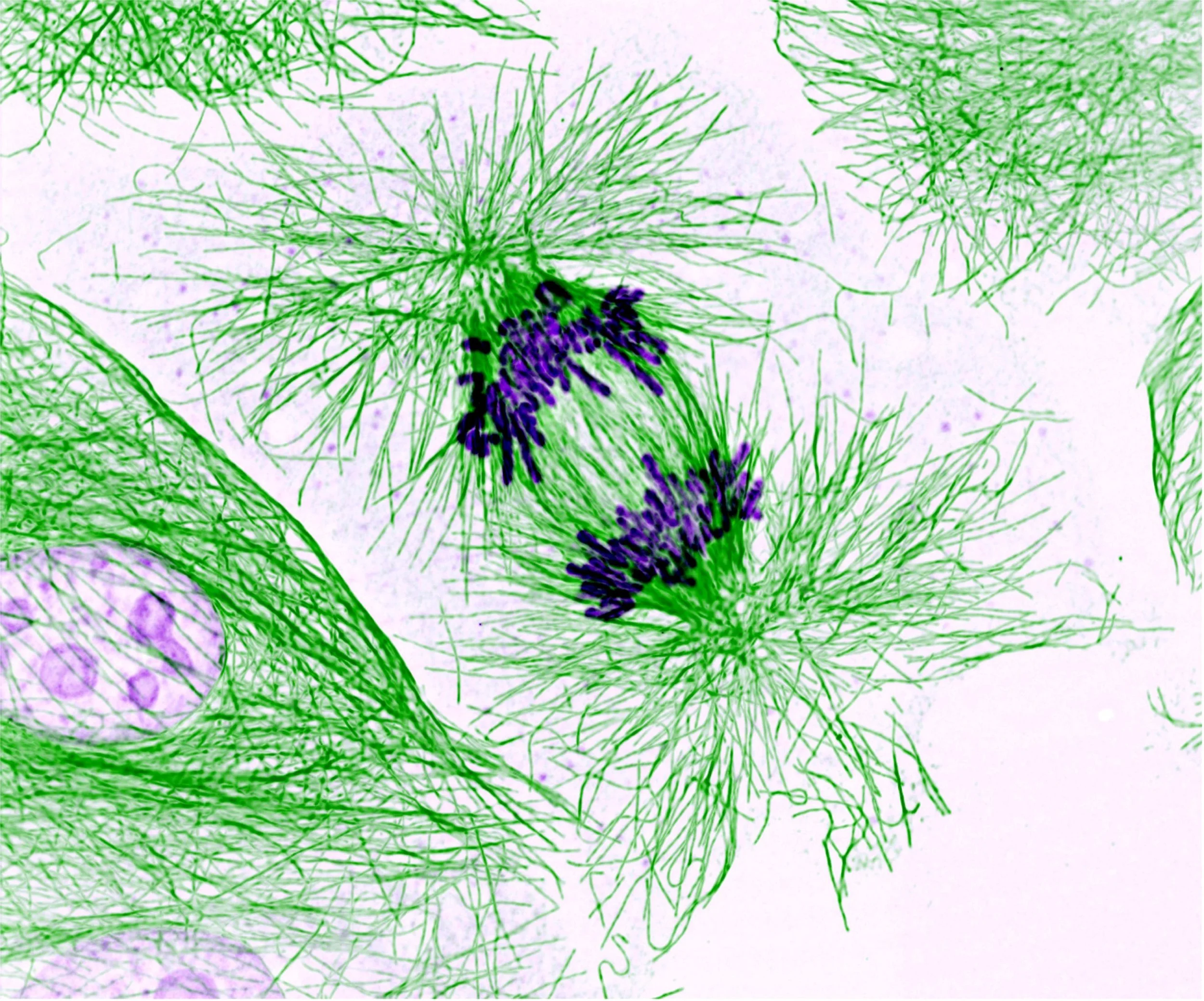 Preliminary medical research is done with cells which are more likely to be sourced from male patients. Zeissmicro/Flickr (CC BY-NC-ND 2.0)