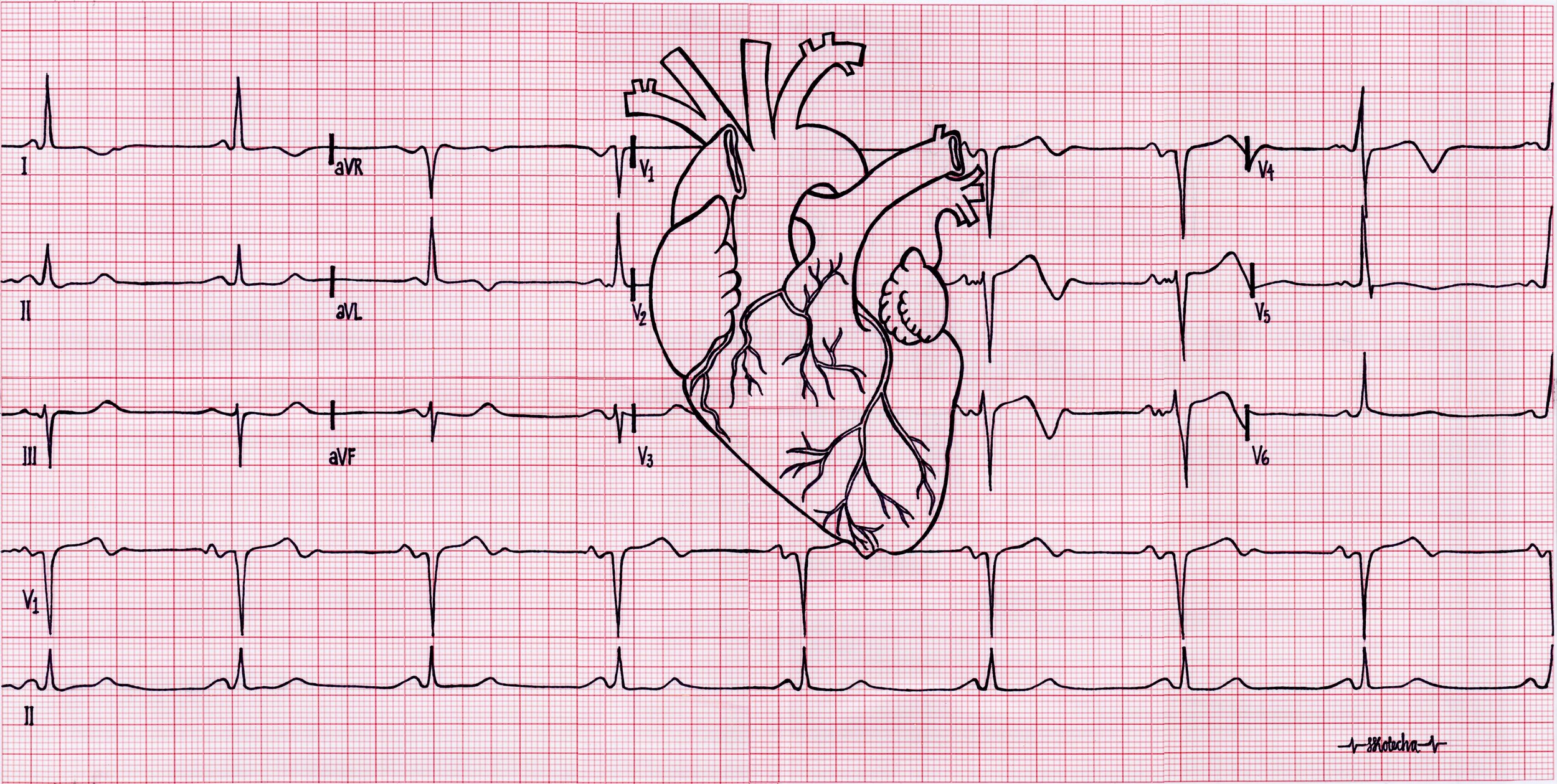 Illustration by Shruti Kotecha, using elements from Jer5150/Wikimedia Commons (CC BY-SA 3.0)