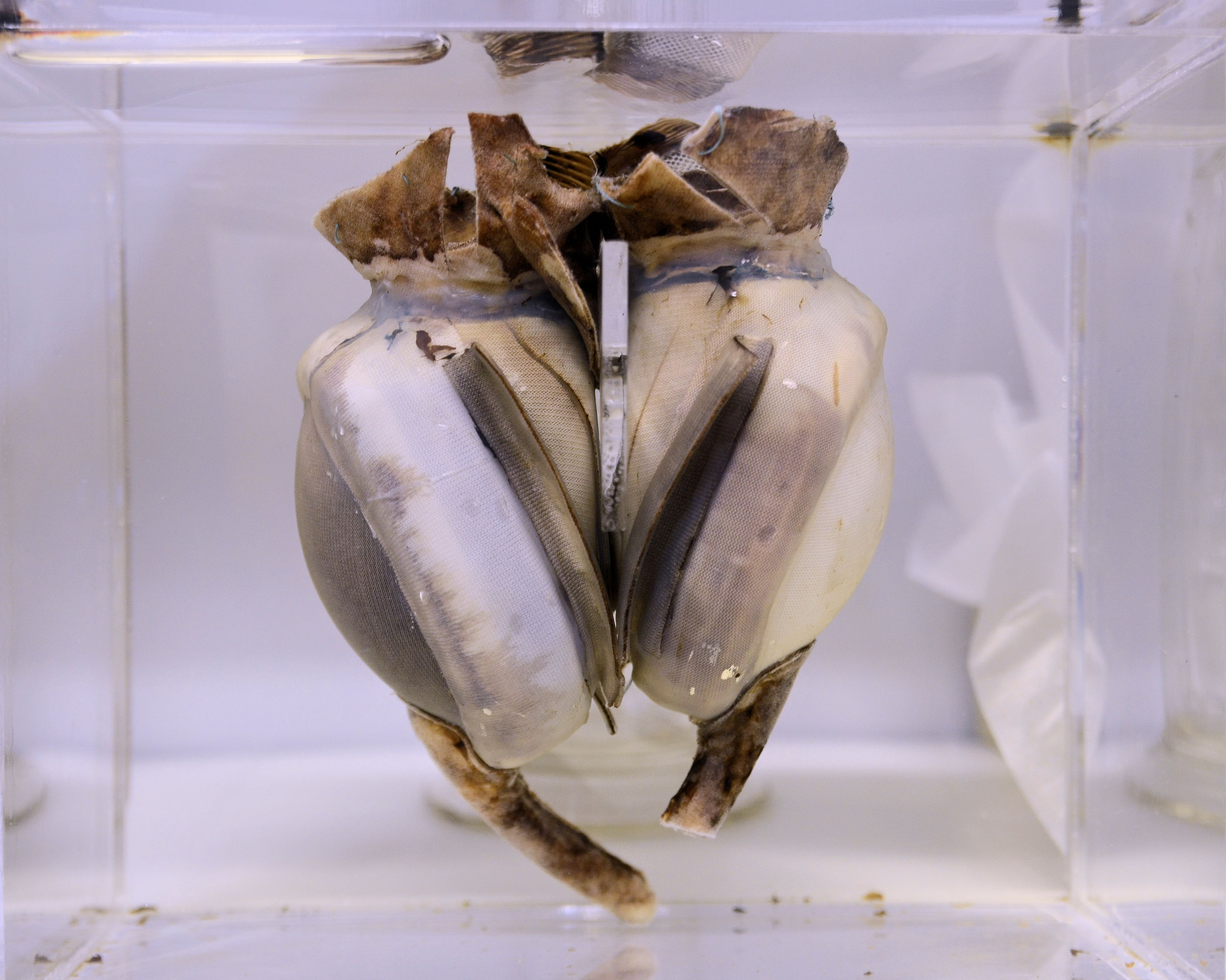 Original prototype of the Liotta-Cooley artificial heart, which spent 64 hours inside a patient. Karon Flage/Flickr (CC BY 2.0)
