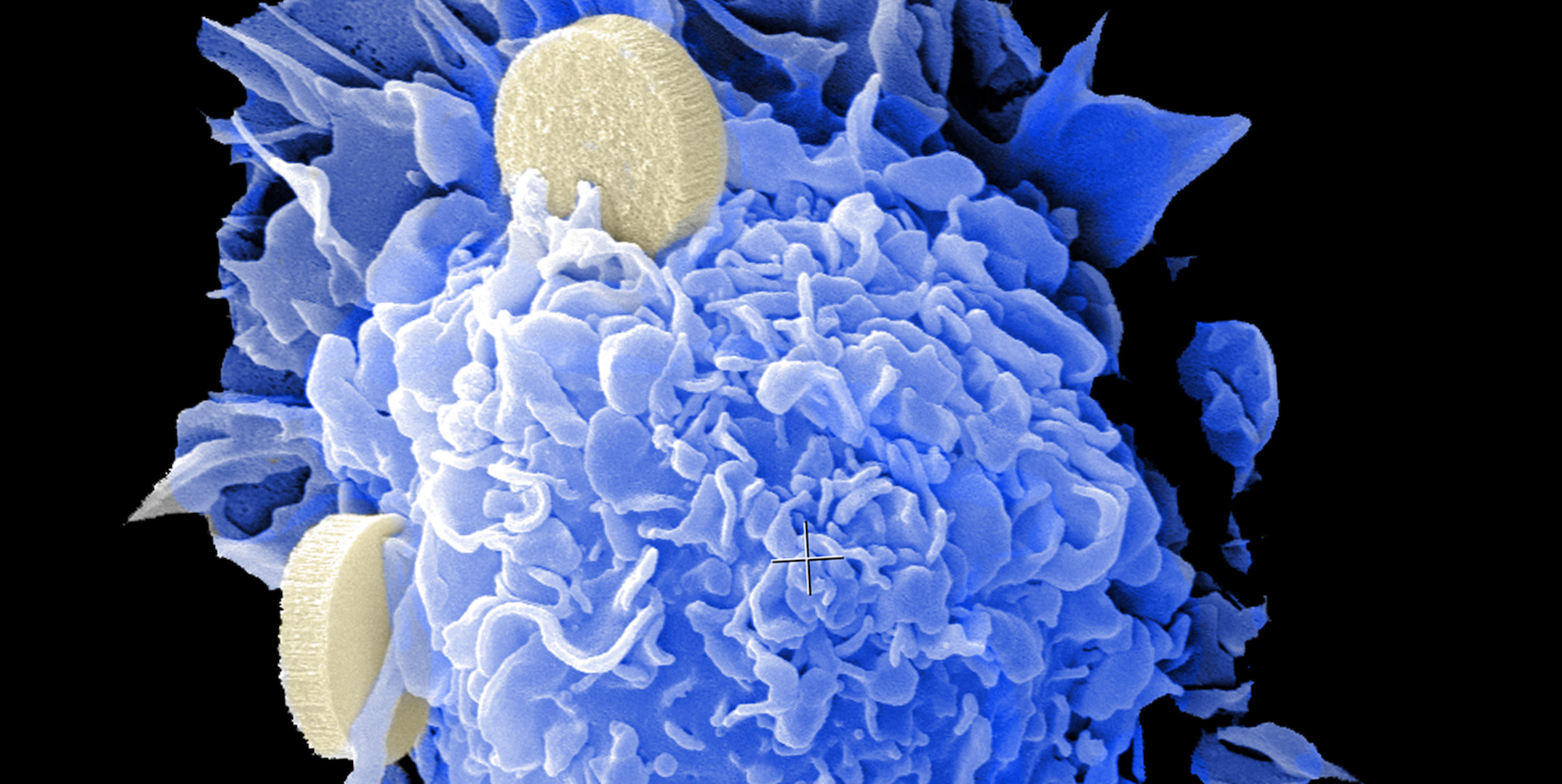 This nano-vaccine can stimulate an anti-tumour response in patients with cancer. Brenda Melendez and Rita Serda, NIH Image Gallery/Flickr (CC BY-NC 2.0)