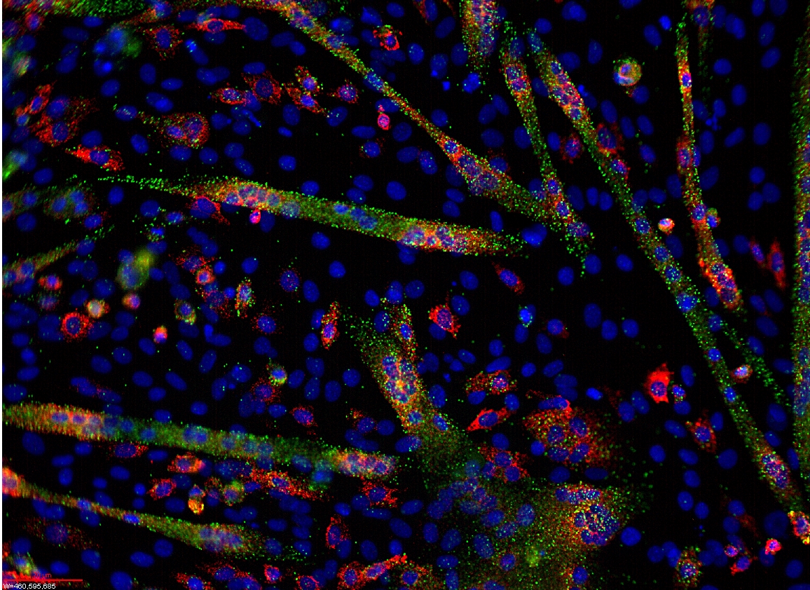 “Biofluid-based biomarkers that actually work in the clinic to favourably change patient care, have historically been hard to come across,” says Prof Tewari from the University of Michigan. But t he presence or absence of specific micro-RNA fragments could be used as biomarkers for disease. (The green strands are micro-RNA.) Ryan Jeffs/Wikimedia Commons (CC BY-SA 3.0)