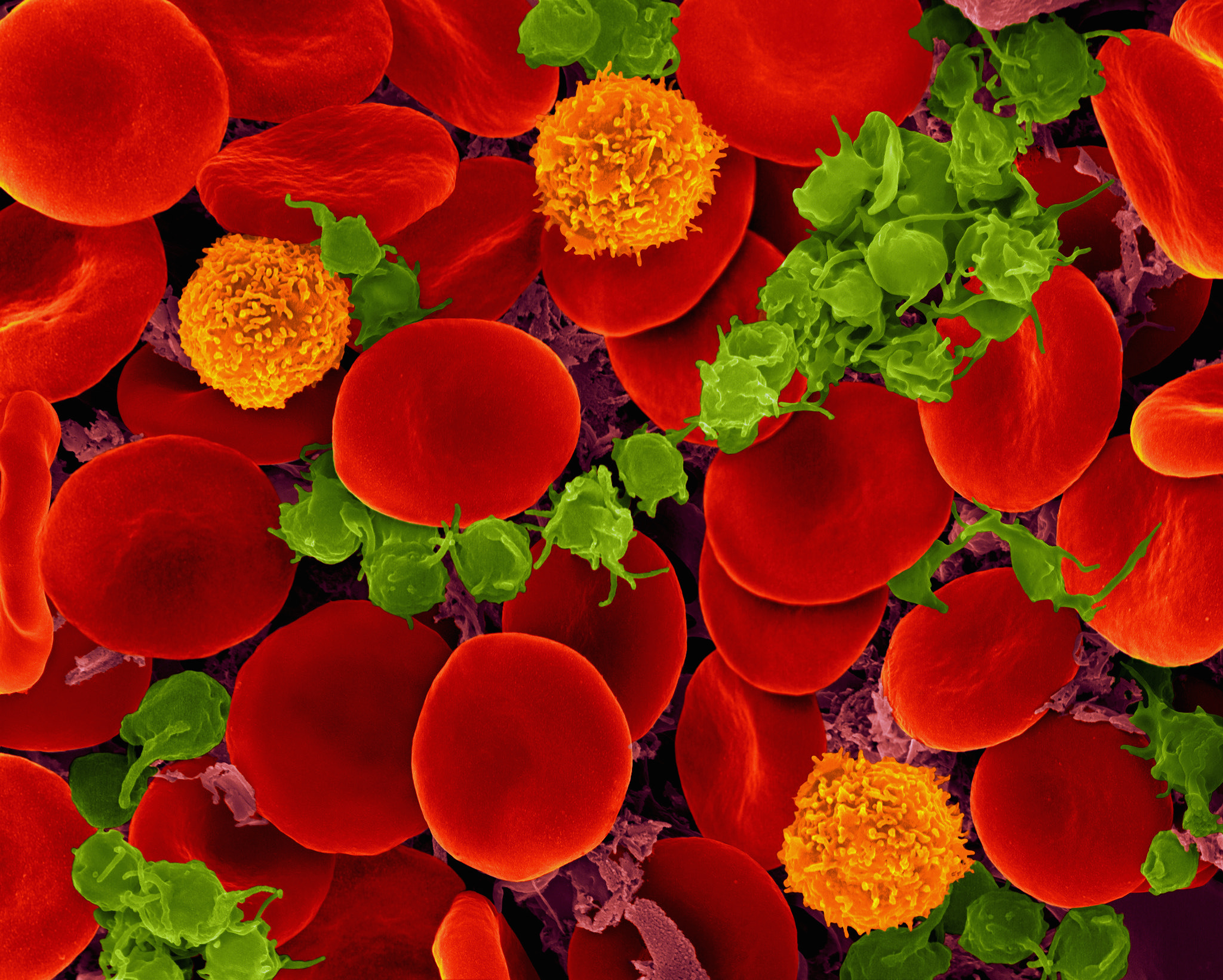 A microscopic look at the blood shows the red blood cells that carry oxygen around our body, and the T cells (orange) and platelets (green) that play other important roles. Zeiss Microscopy/Flickr (CC BY-NC-ND 2.0)