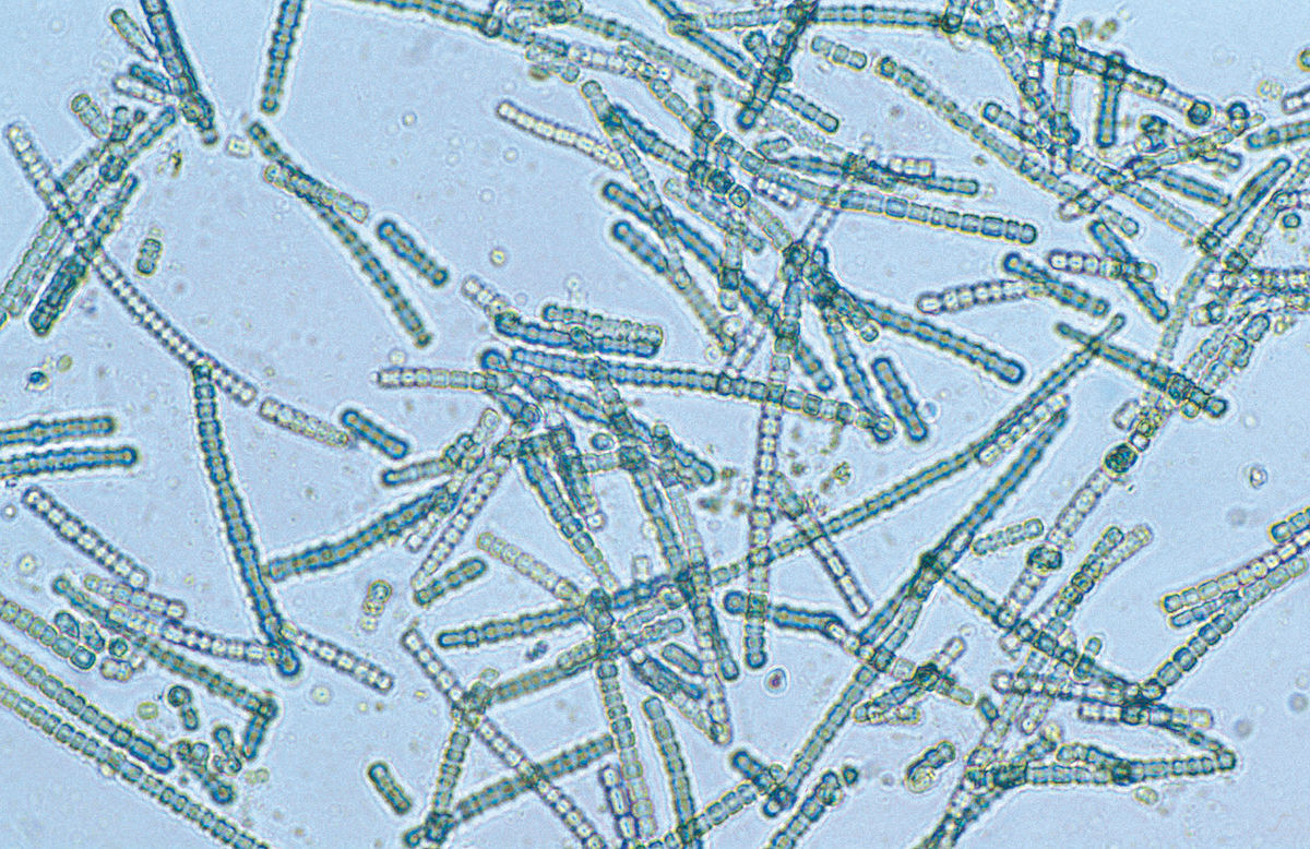 A species of cyanobacteria viewed under a light microscope - Could we use these microbes to harness photosynthesis directly for the synthesis of high-value molecules? Willem van Aken, CSIRO/Wikimedia Commons (CC-BY-3.0).