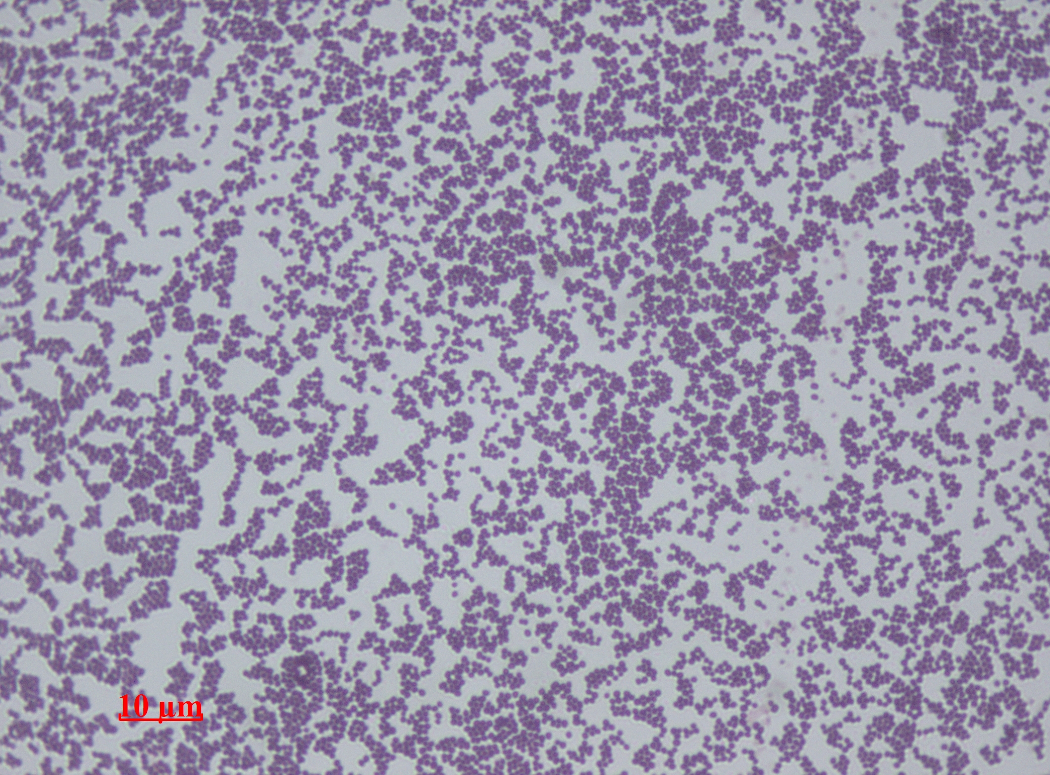 An image of Staphylococcus epidermidis under the microscope. Staphylococci are among the most common bacteria on human skin. Dr. Sahay/Wikimedia (CC-A-SA 3.0)
