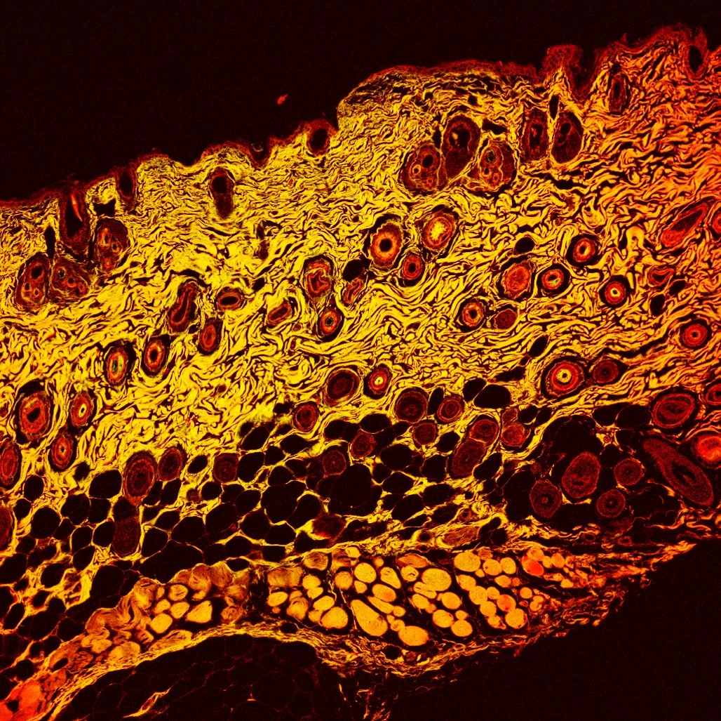 ‘Aboriginal Art’, by Monash University PhD student Nazia Tabassum came in second place. Image shows close-up mouse skin, showing sebaceous glands, hair follicle bulbs, distinct layers of skin, and other details.