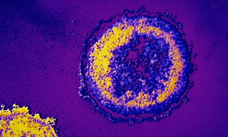 Microscope image of the HIV virusq