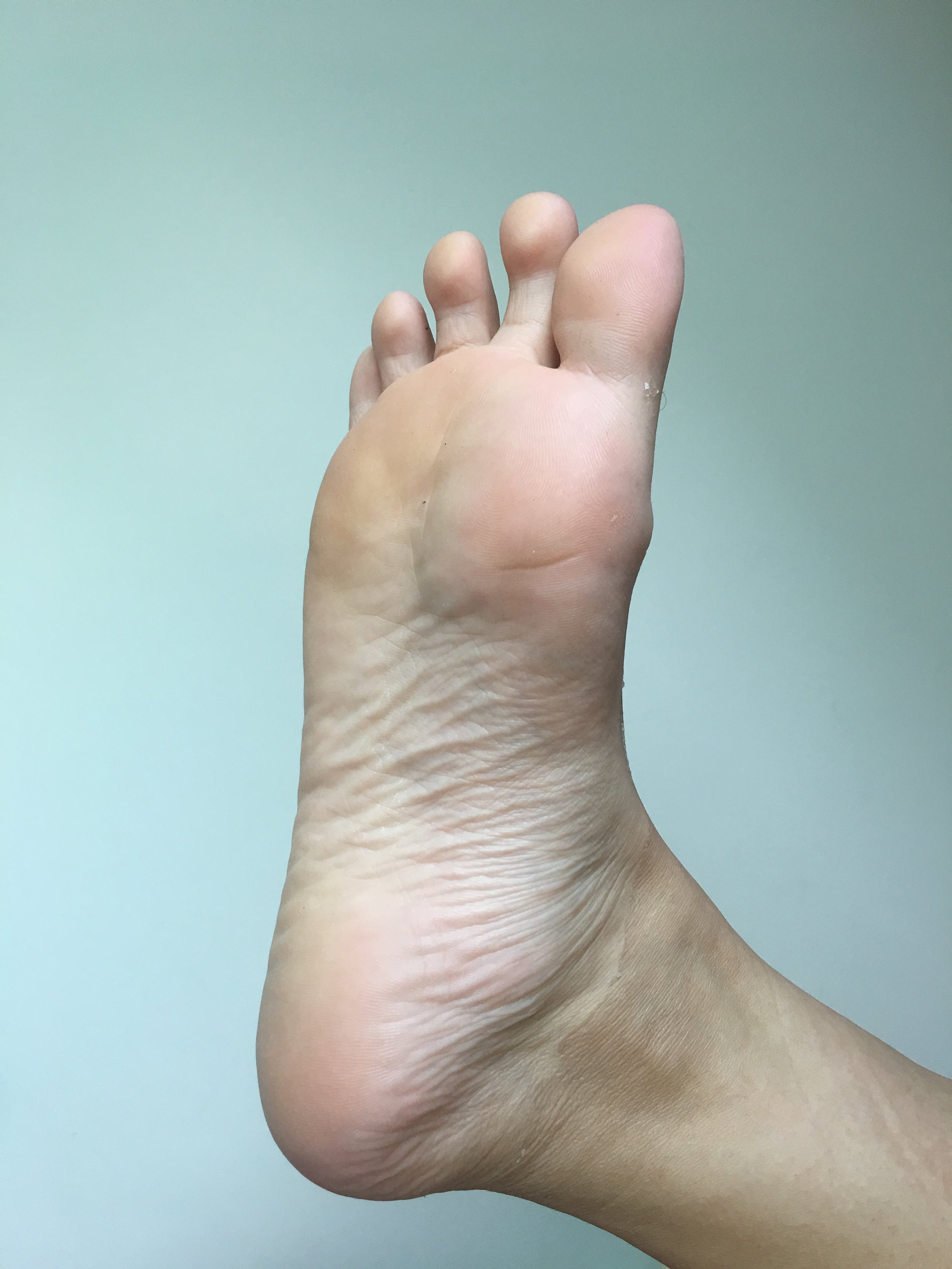 Foot Peels Smelly Feet No More Diana Lim 林素名