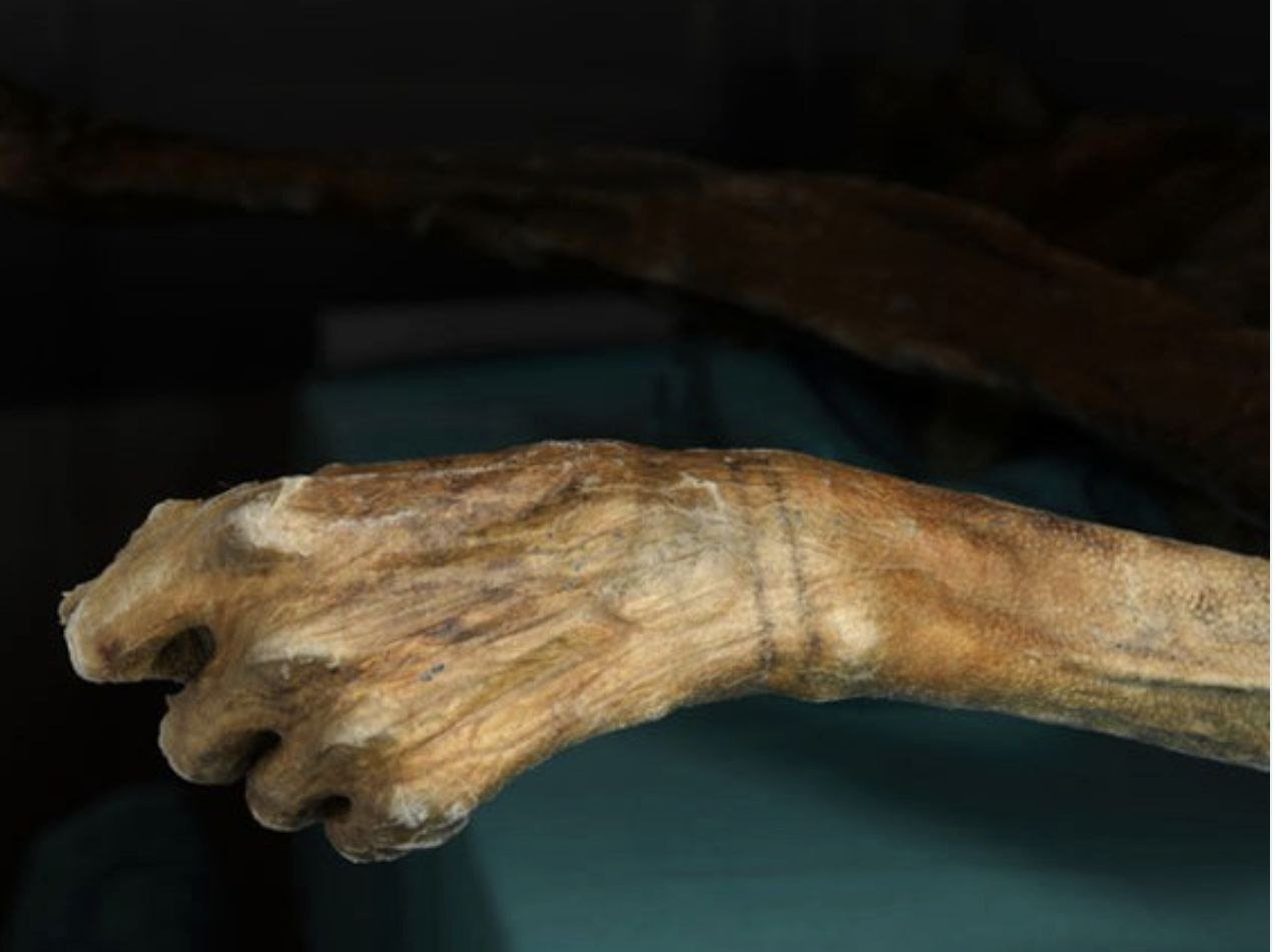 Ötzi's original wrist tattoos