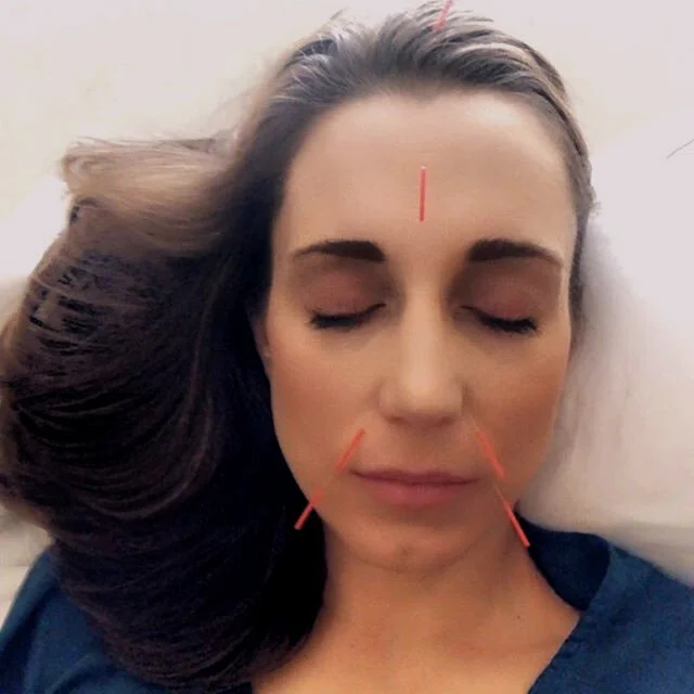 Longevity Acupuncture Clinic