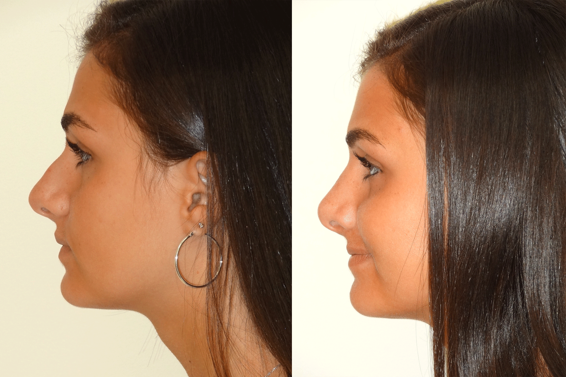 Nose8_Left.jpg