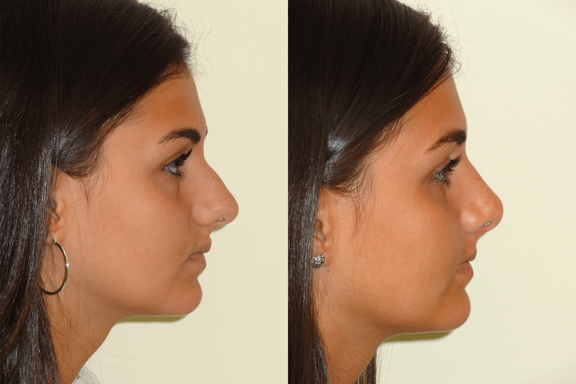 Nose8_Right.jpg