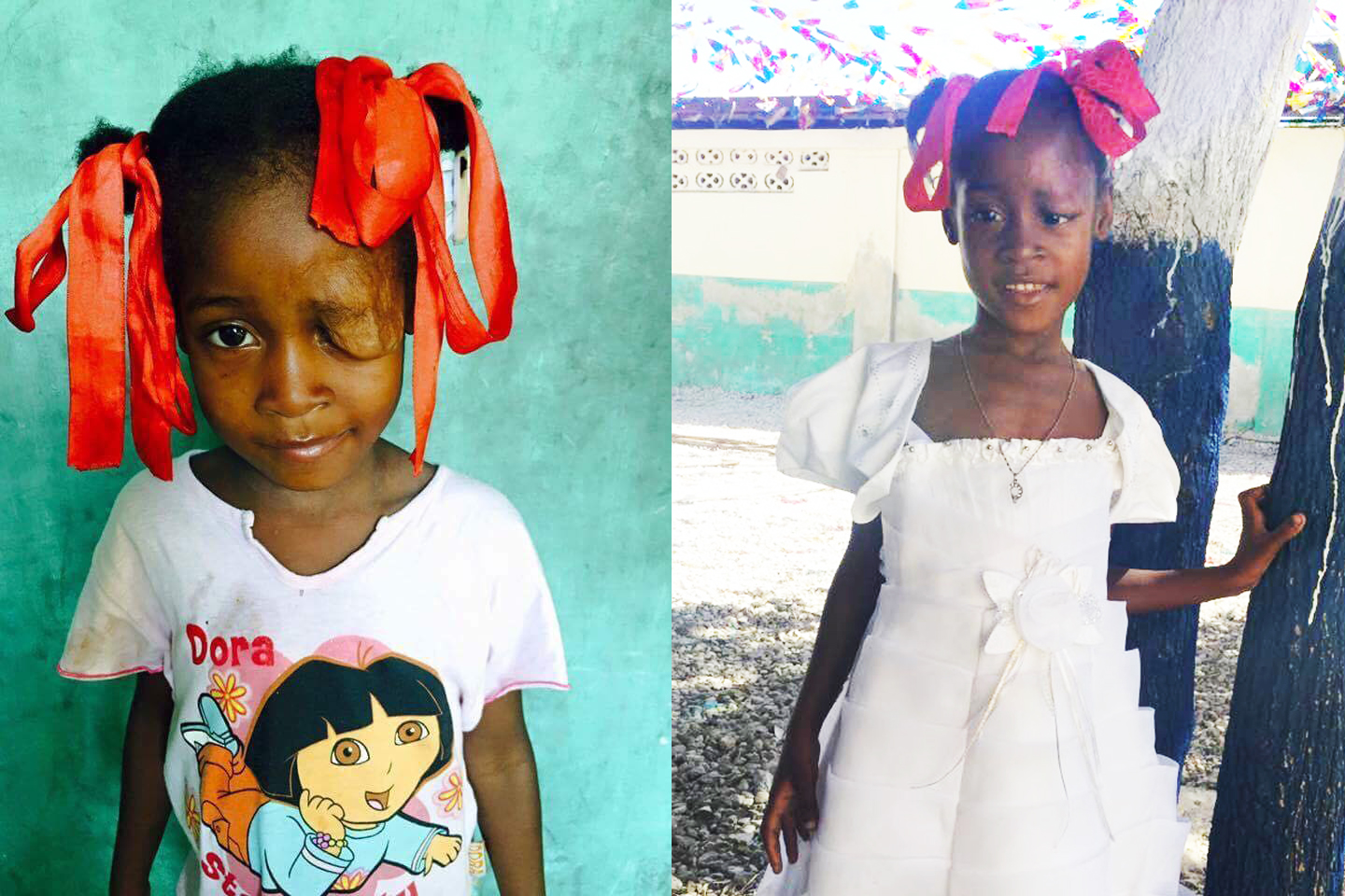 Taina Before and After2.jpg
