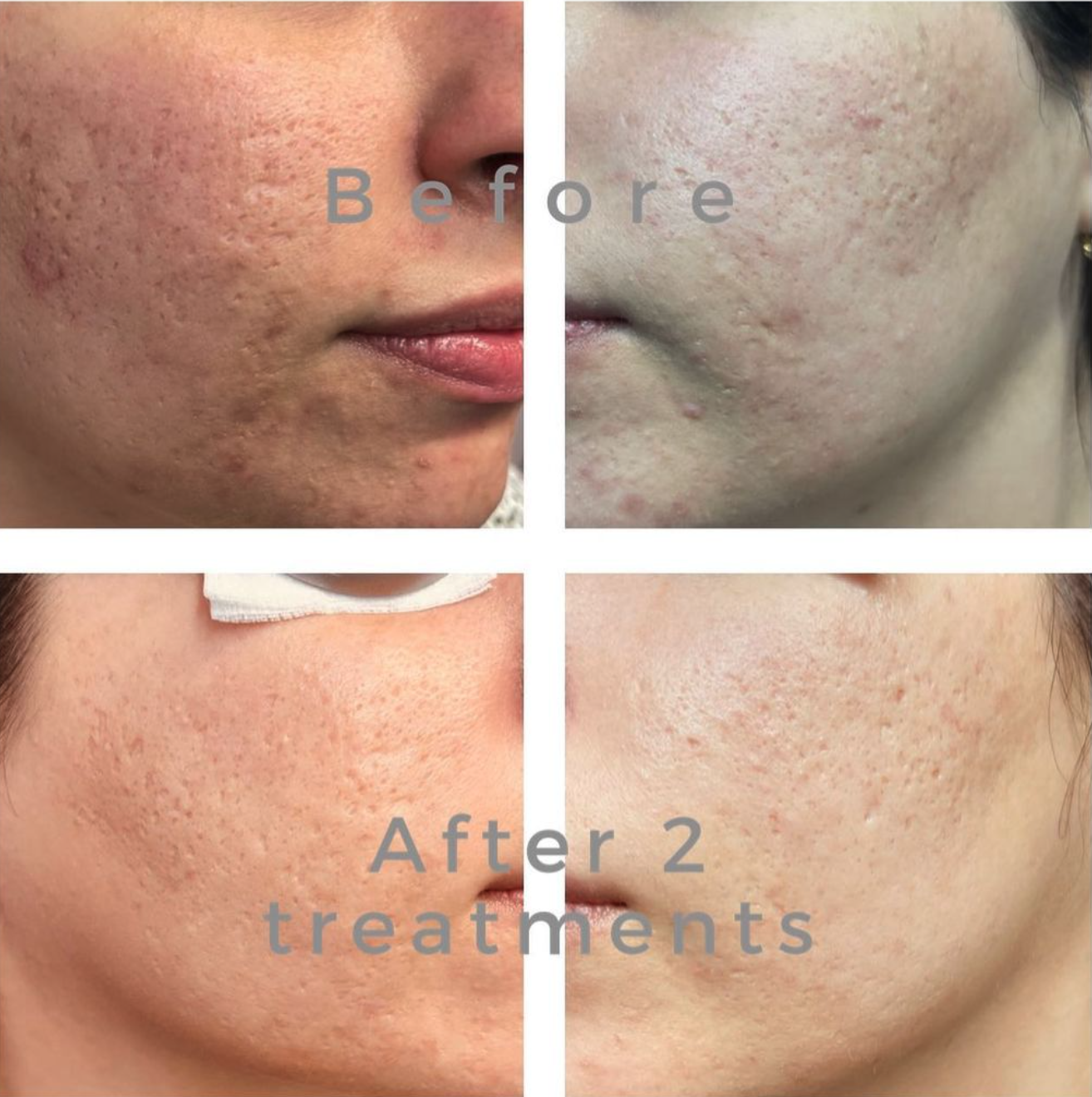 benefits of regular facials