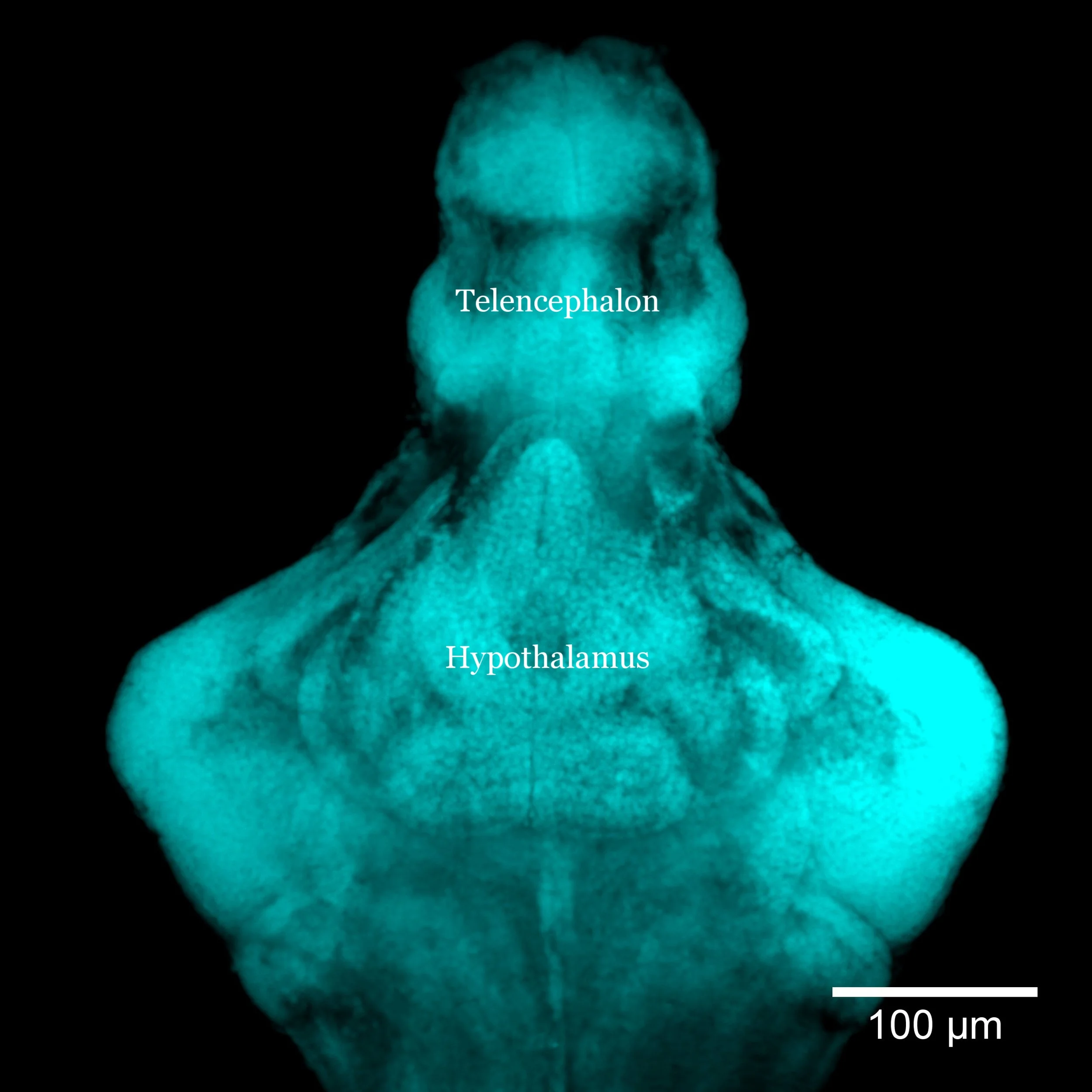  1 week old zebrafish brain (DAPI staining)