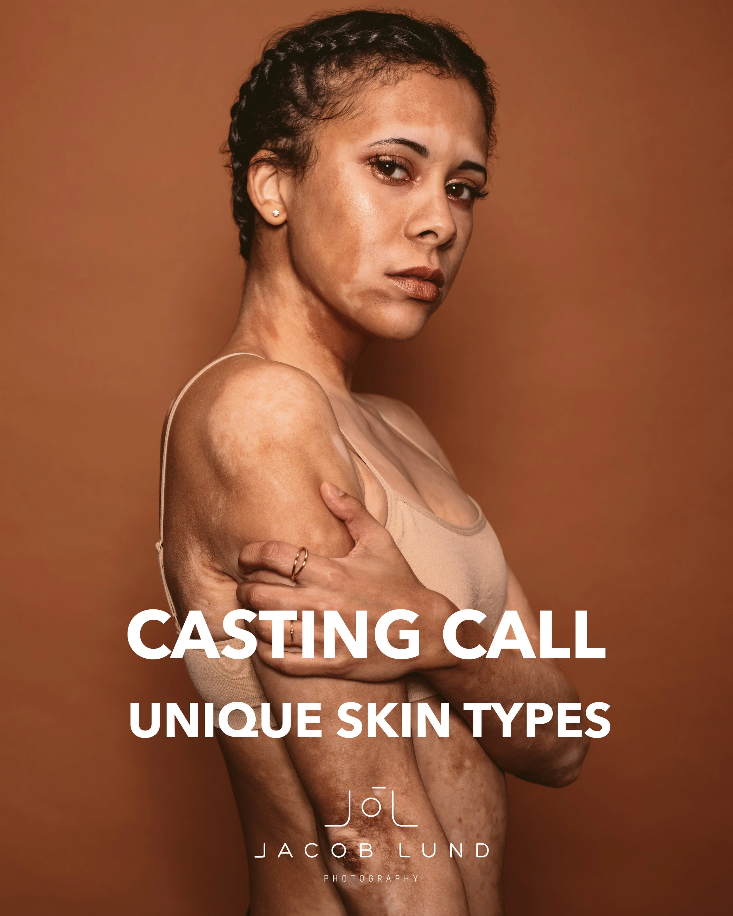 Casting call: Unique skin types