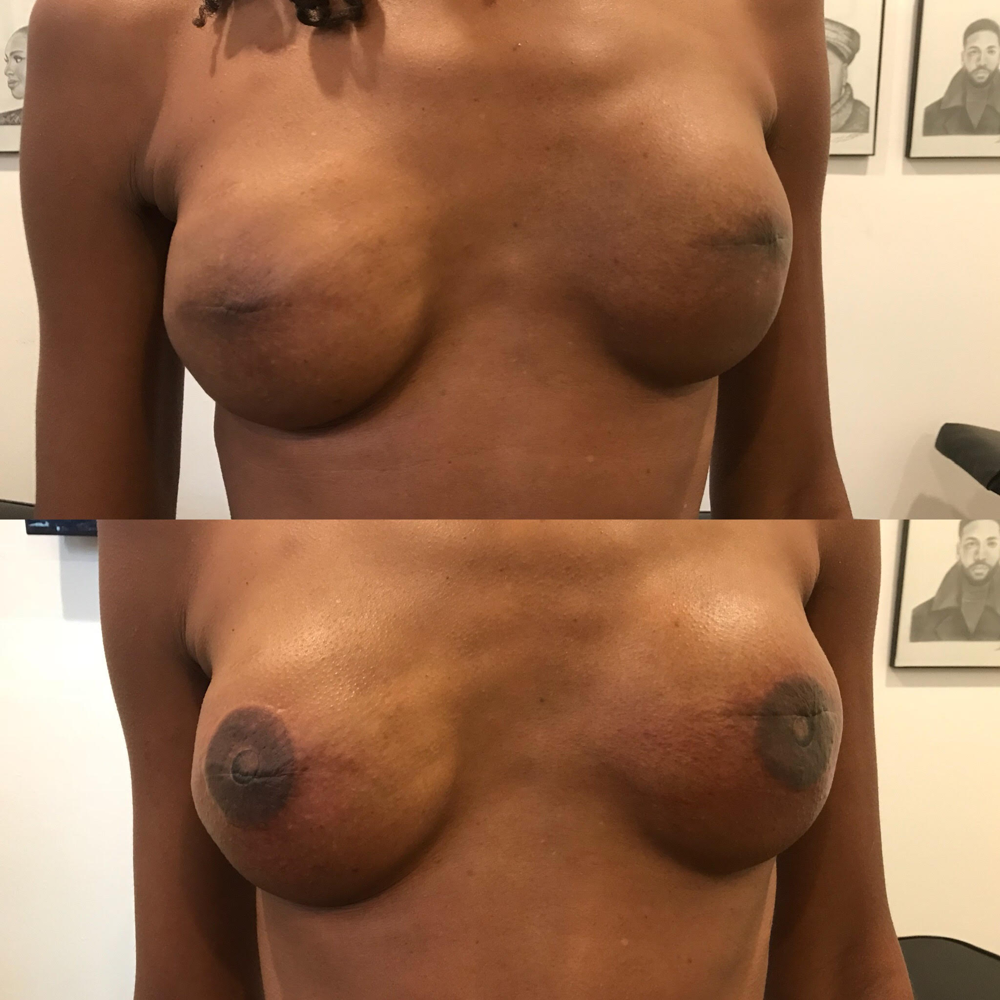 nipples.jpg
