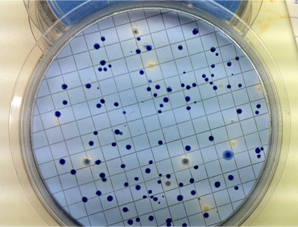 Fecal coliform colonies. Clayton Manning/Project Seahorse
